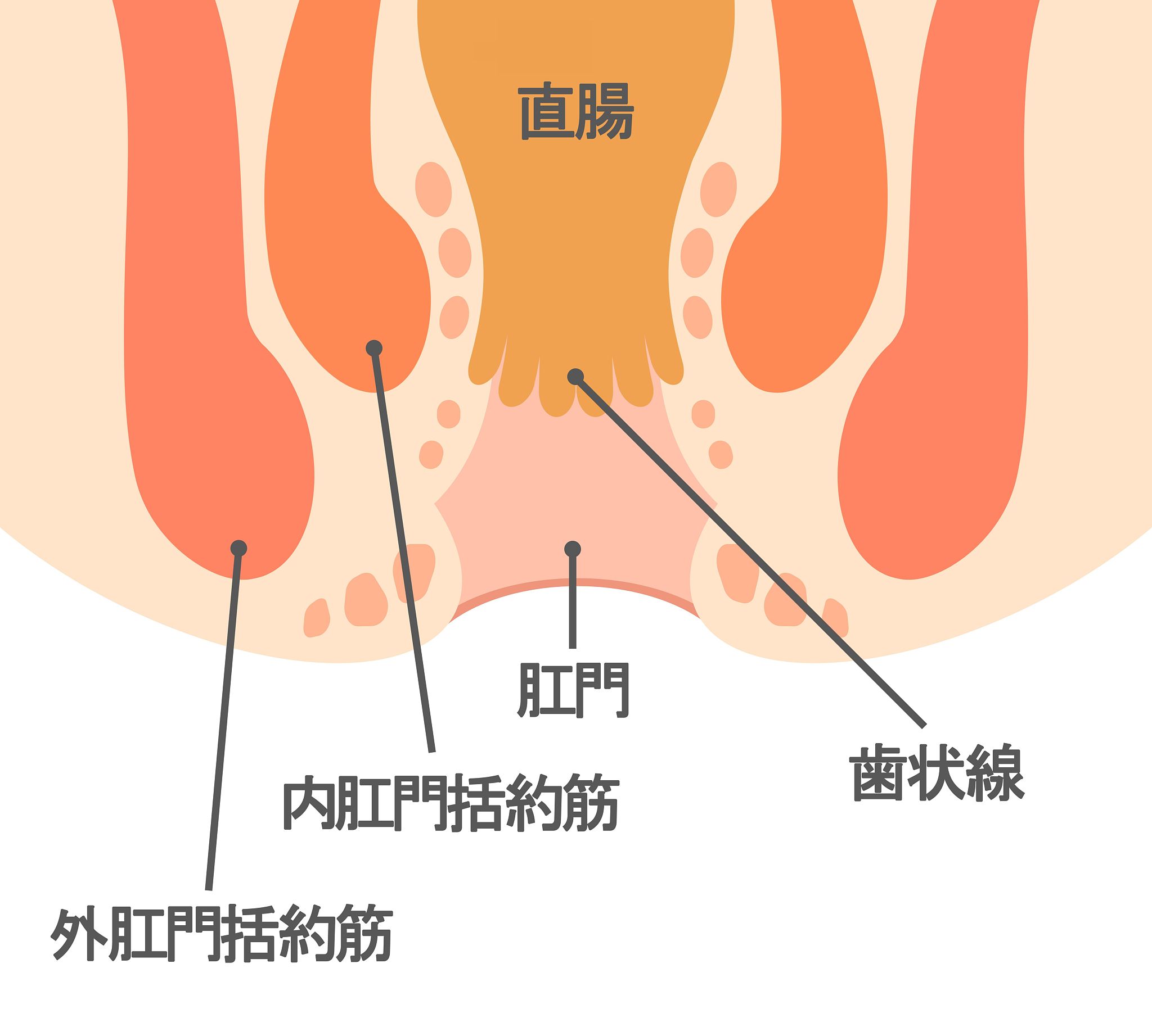 如何预防肛门湿疹