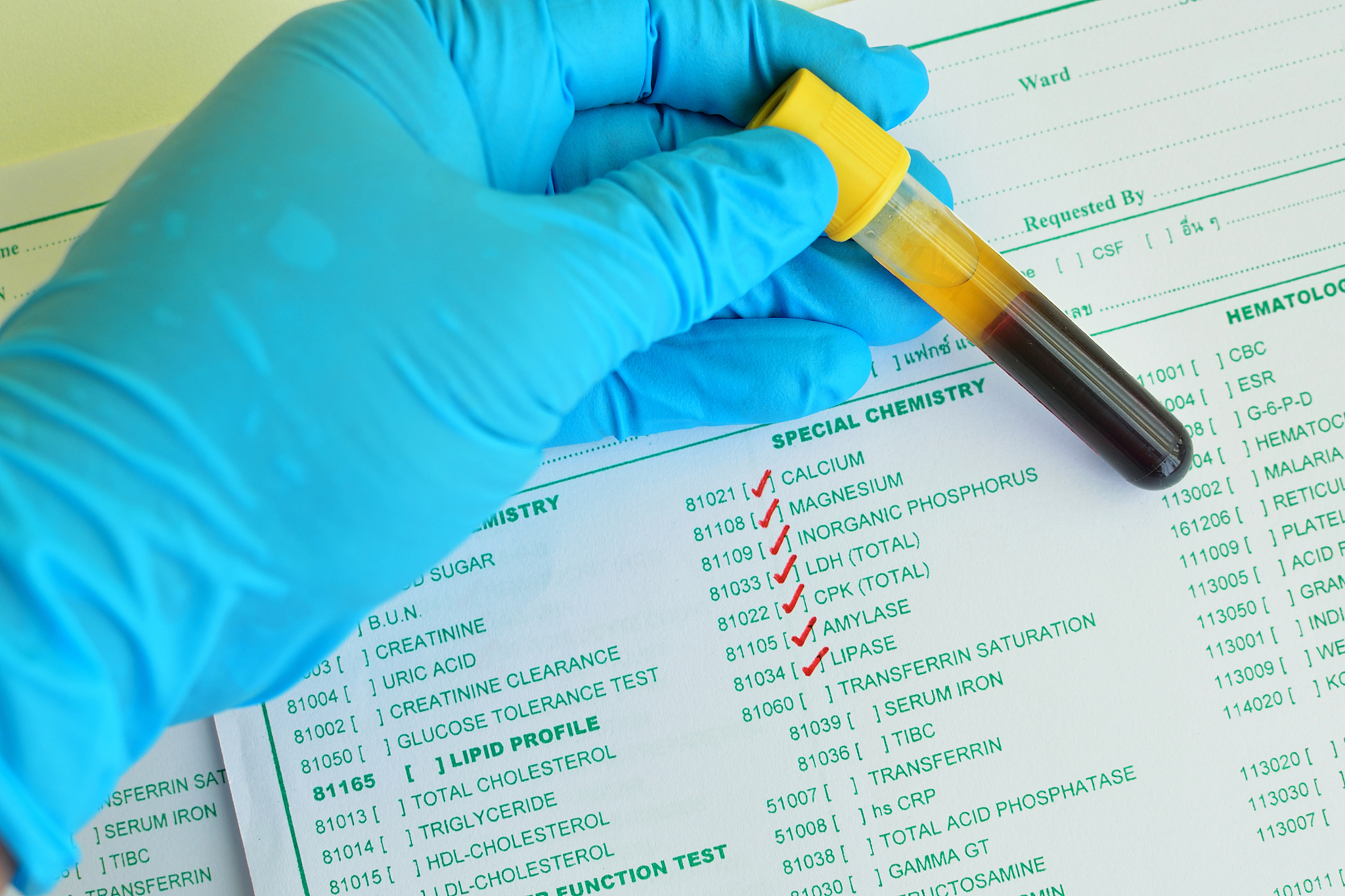 代谢性酸中毒外科常考