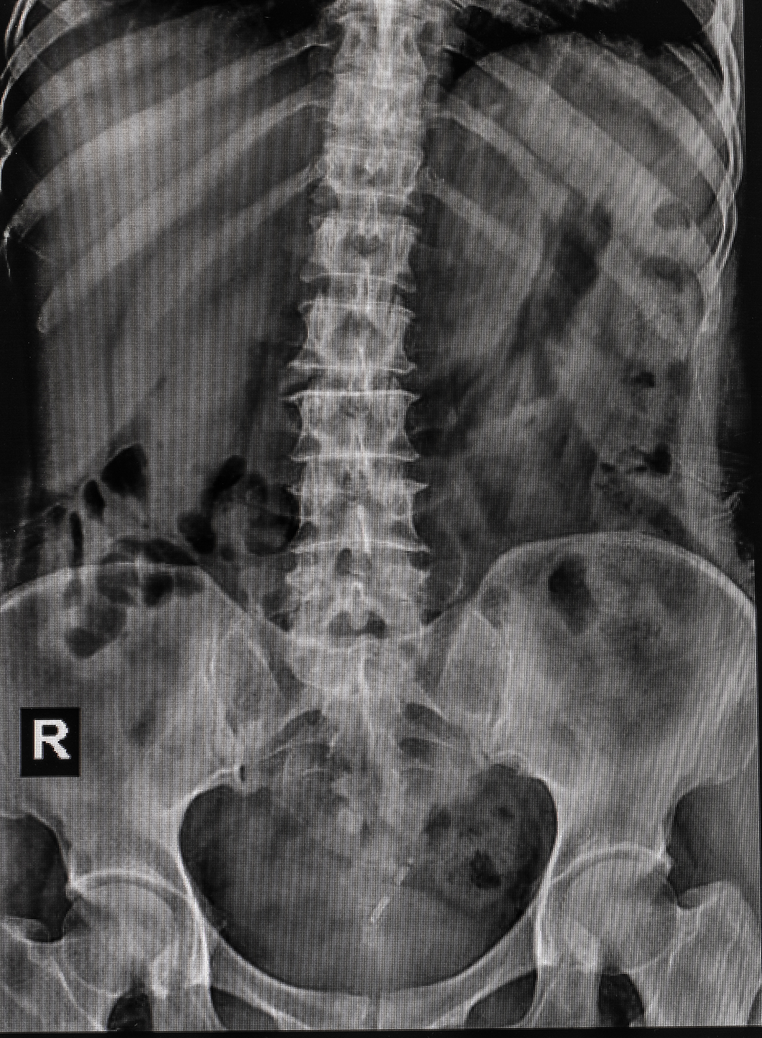 请使用高级语法及词汇润色以下句子：Figure 2 shows X-ray diffraction pattern of the composites fabricated by SPS sintered at different temperatures using Cu Cu-coated graphite and Cr2AlC as the raw materials