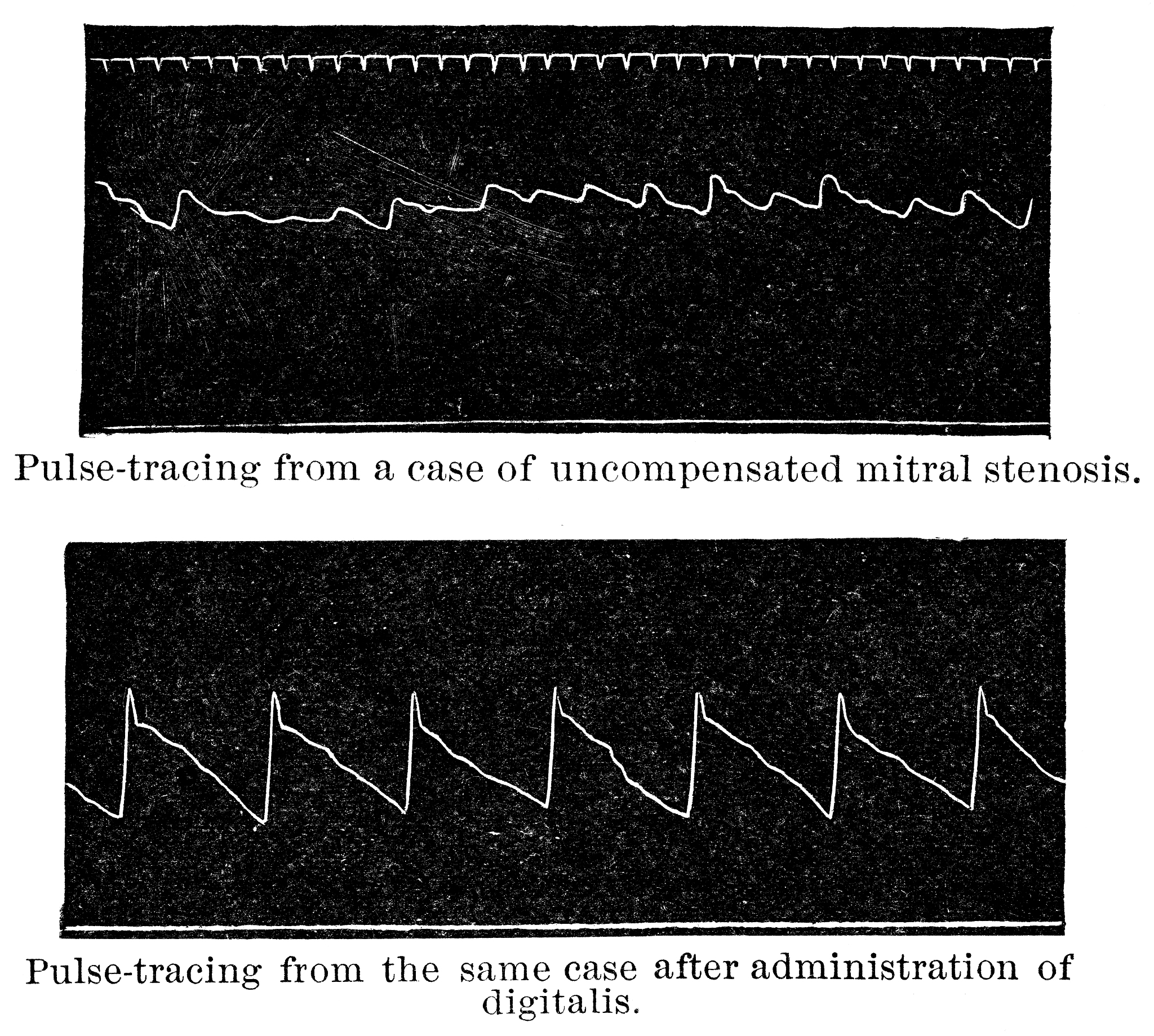 睡觉的时候大脑是什么波形？