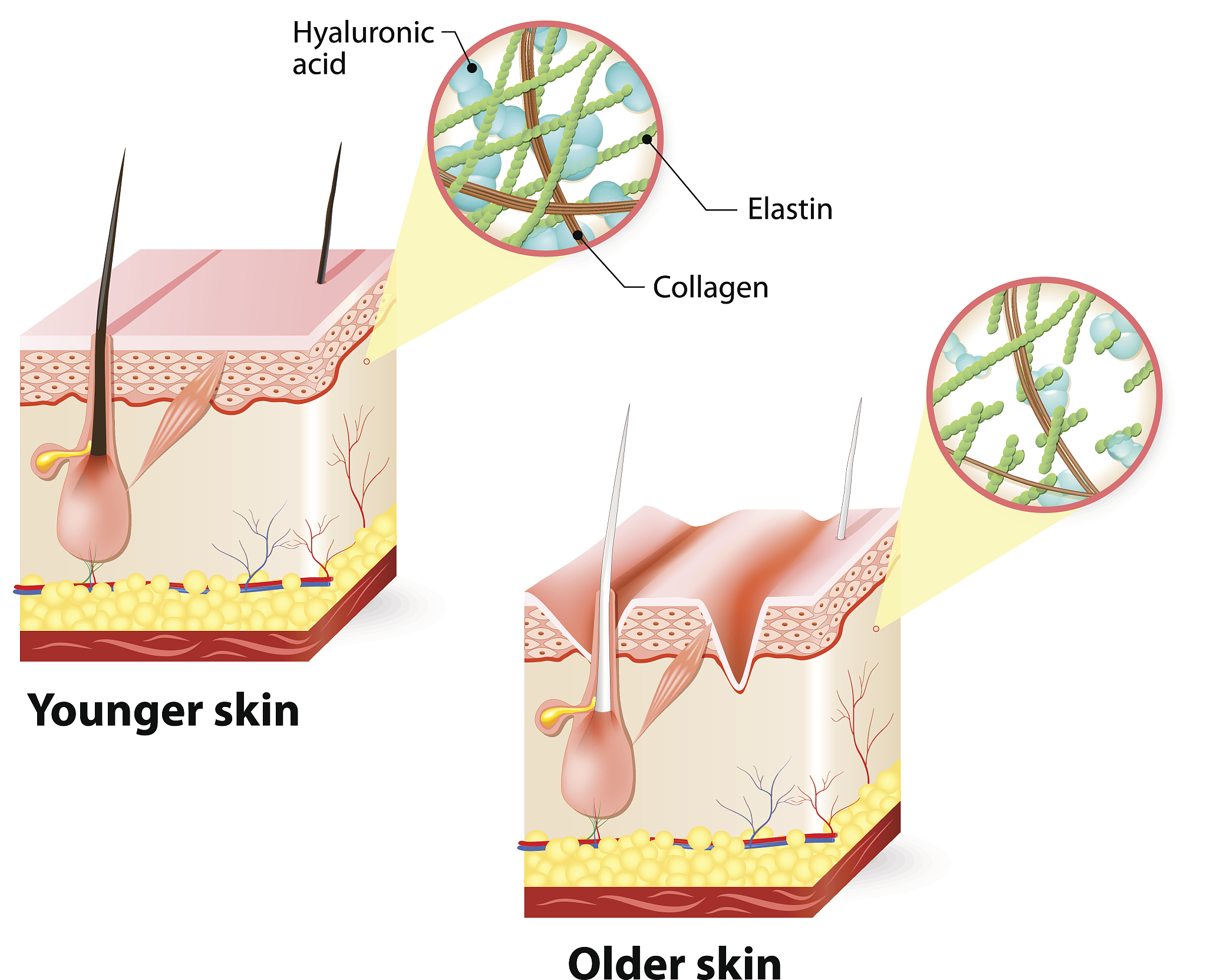 胶原蛋白是否是真正的蛋白质
