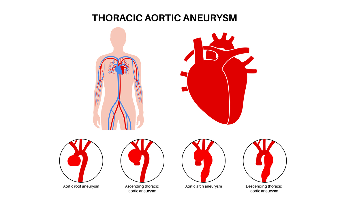 人体血液循环流程详解：心脏 - 动脉 - 毛细血管 - 静脉