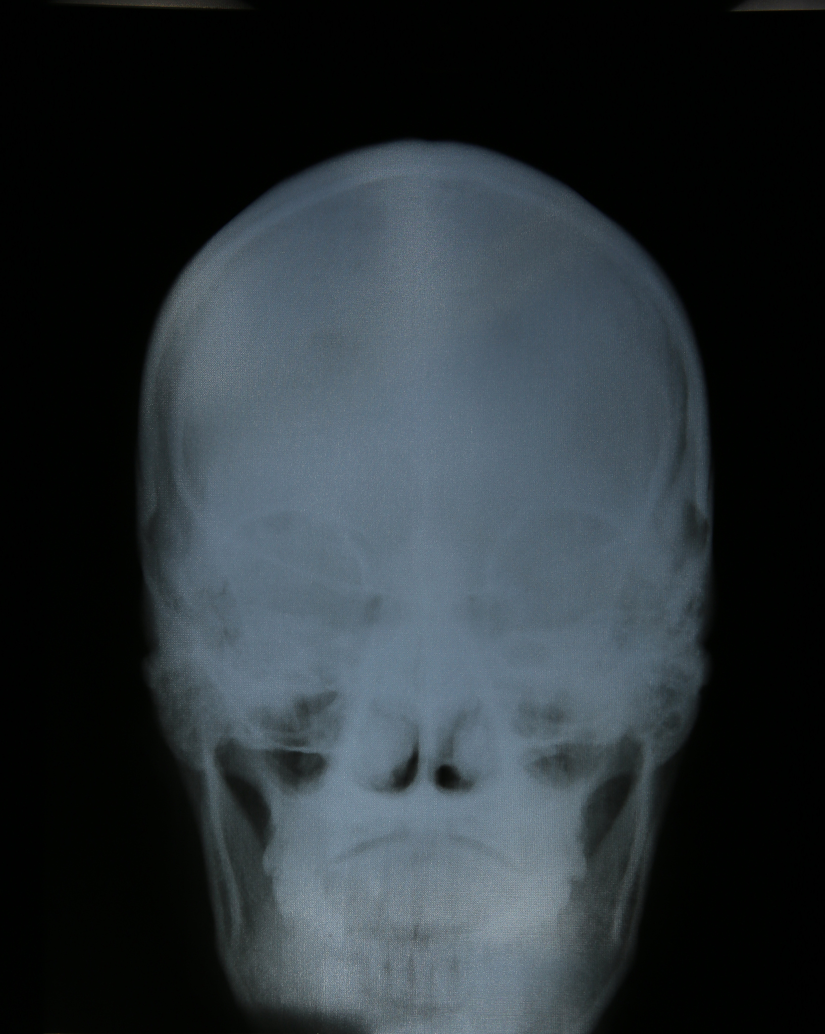 CT建模与人脸建模结合：多模态建模的应用