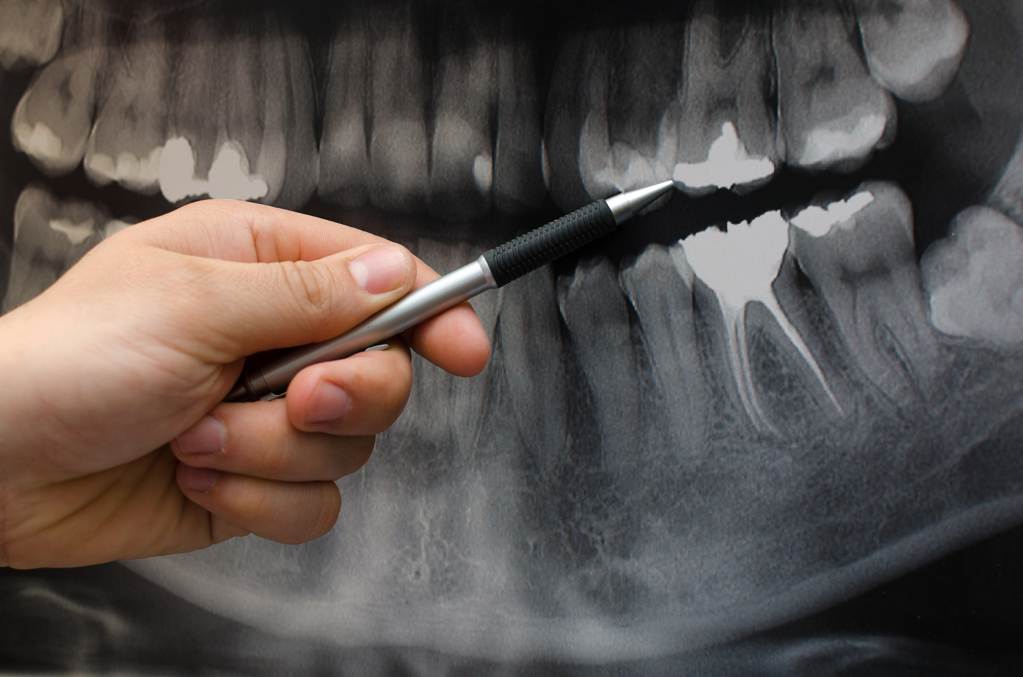 重庆高职院校卫校专业：就业前景广阔