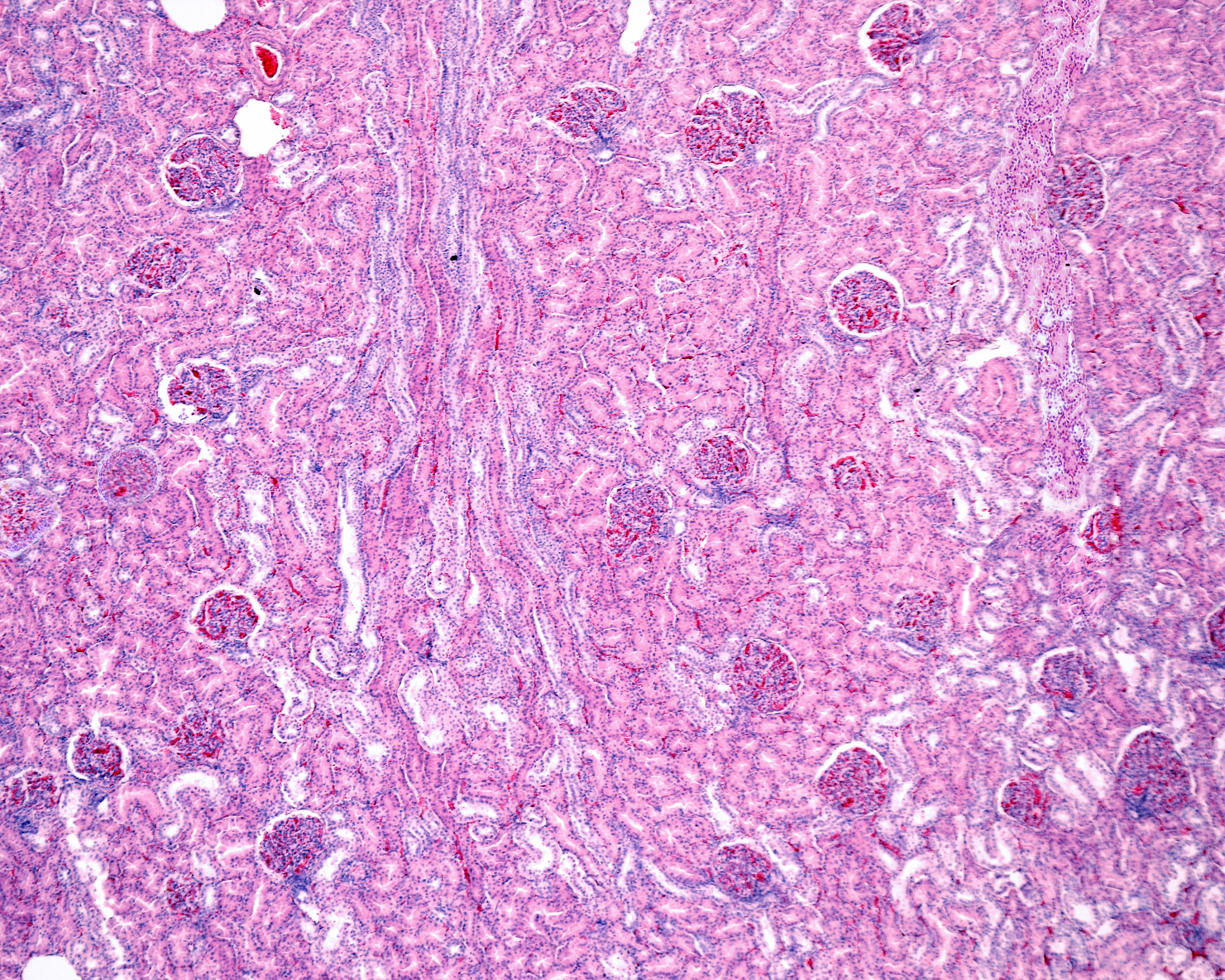 蛋白尿的发生机制