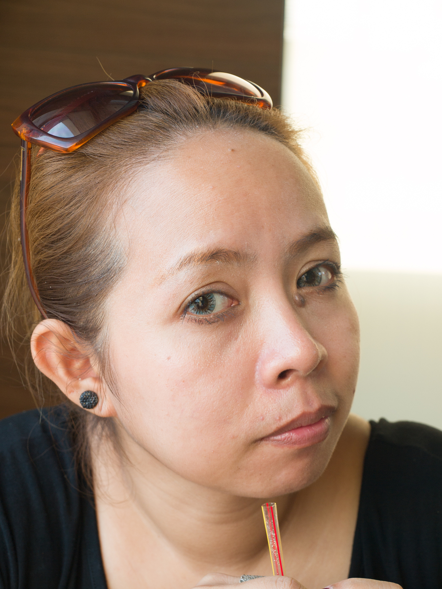 成年后长出来的痣如何辨别良性恶性