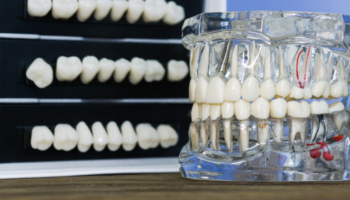 成都卫生学校：口腔修复技术与口腔医学的区别