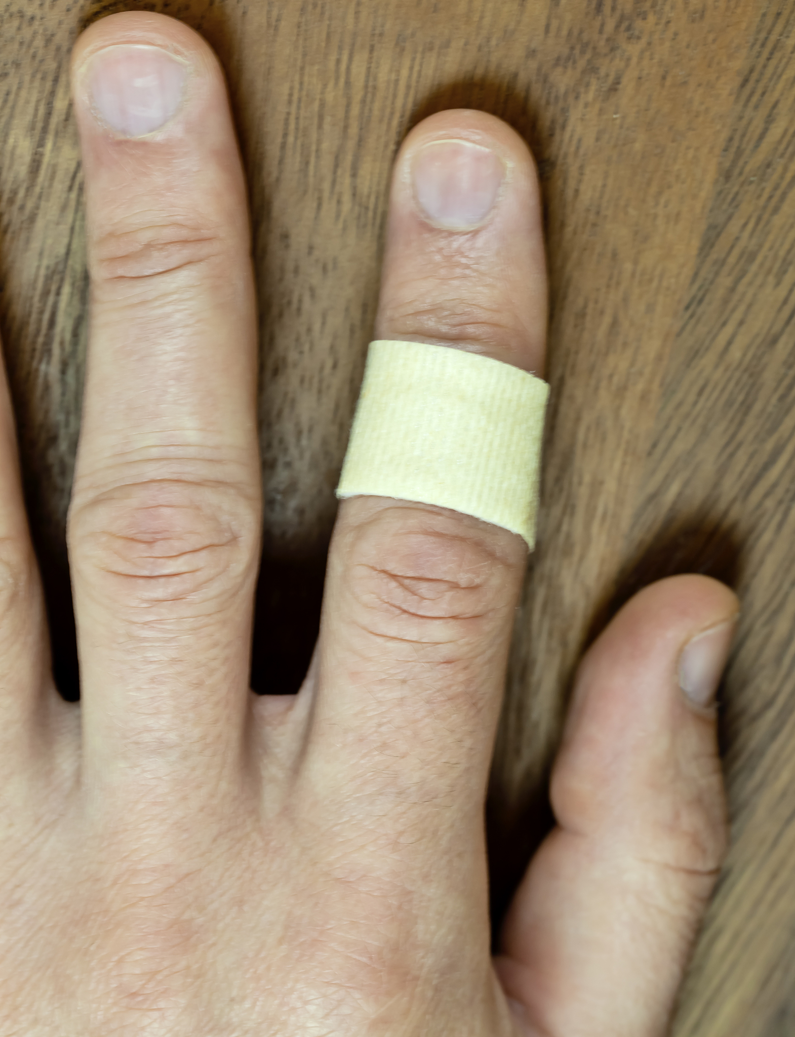 手部软组织感染：症状、治疗及预防