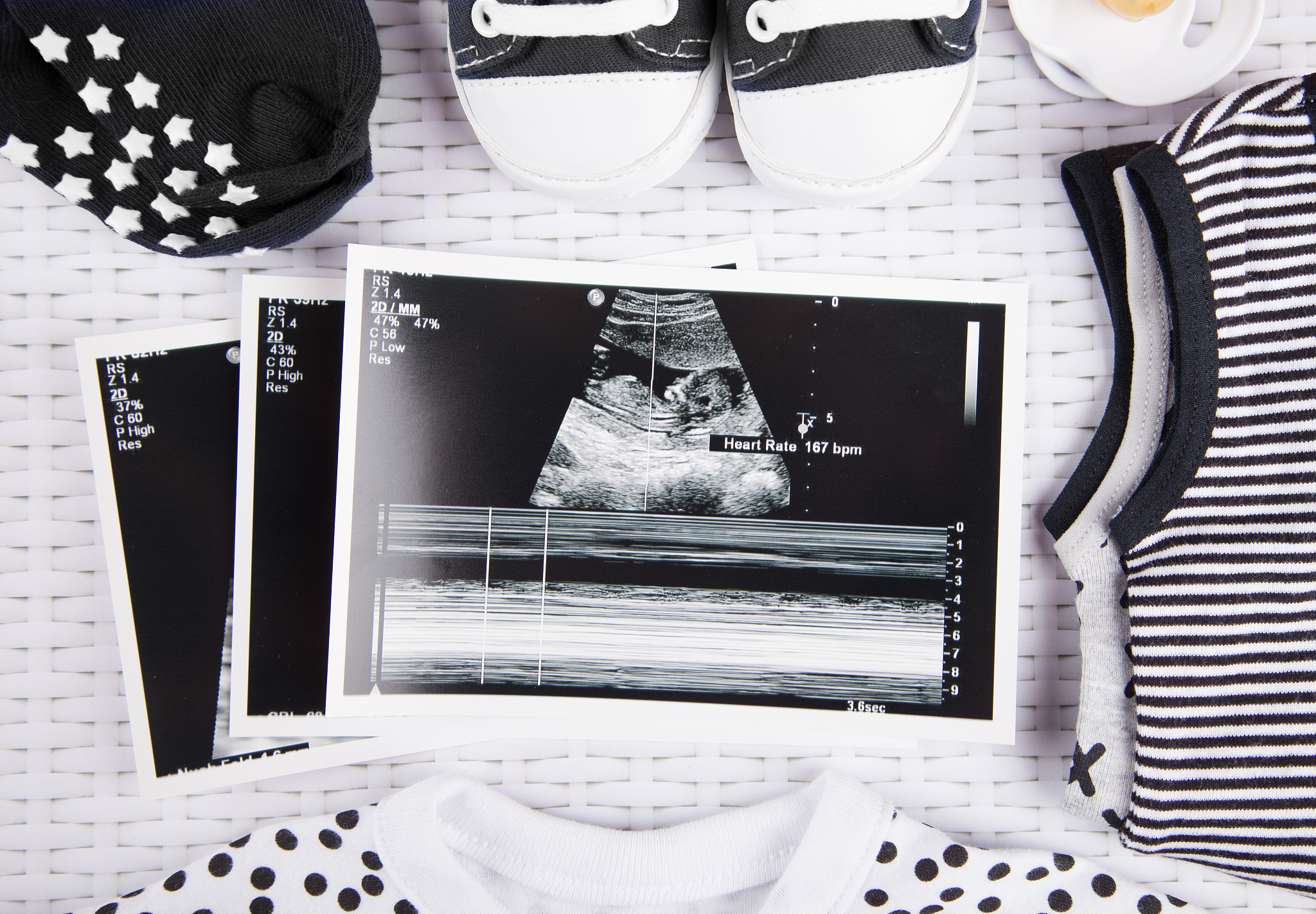 pregnancy test & ultrasound photo