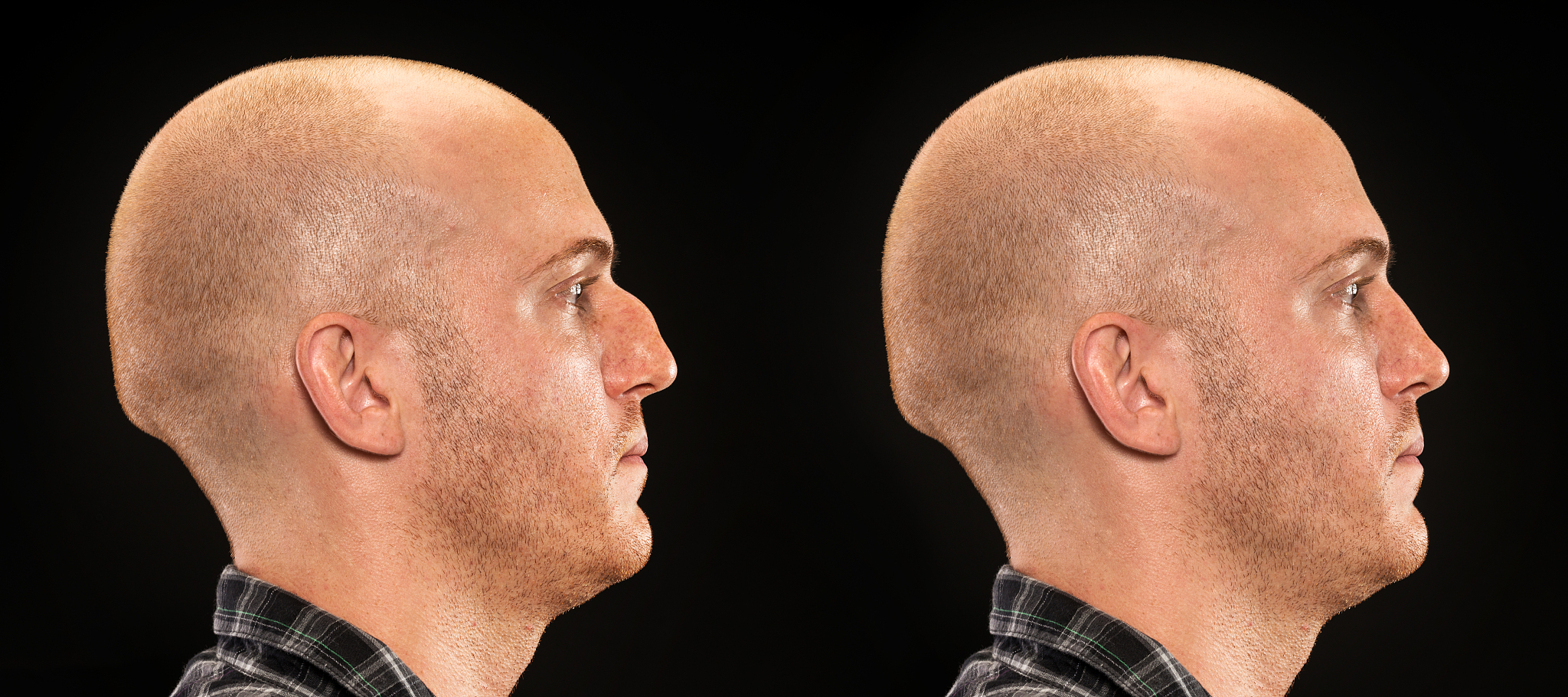 你正在写一篇中文文章每一行必须使用p标签第一行必须用上海隆鼻整形医院哪家好H1标签来书写。文章的第一段必须回答上海隆鼻整形医院哪家好提出的问题不低于400单词的回答内容根据上海隆鼻整形医院哪家好话题进行拓展延伸小标题文章请从3到5个方面以上做详细的阐述每个方面要有3个以上的自然段整篇文章内容只推荐1家医院并详细介绍这家医院的优势内容结构必须符合百度SEO优化内容用数字罗列撰写段落命名开头必须使用H