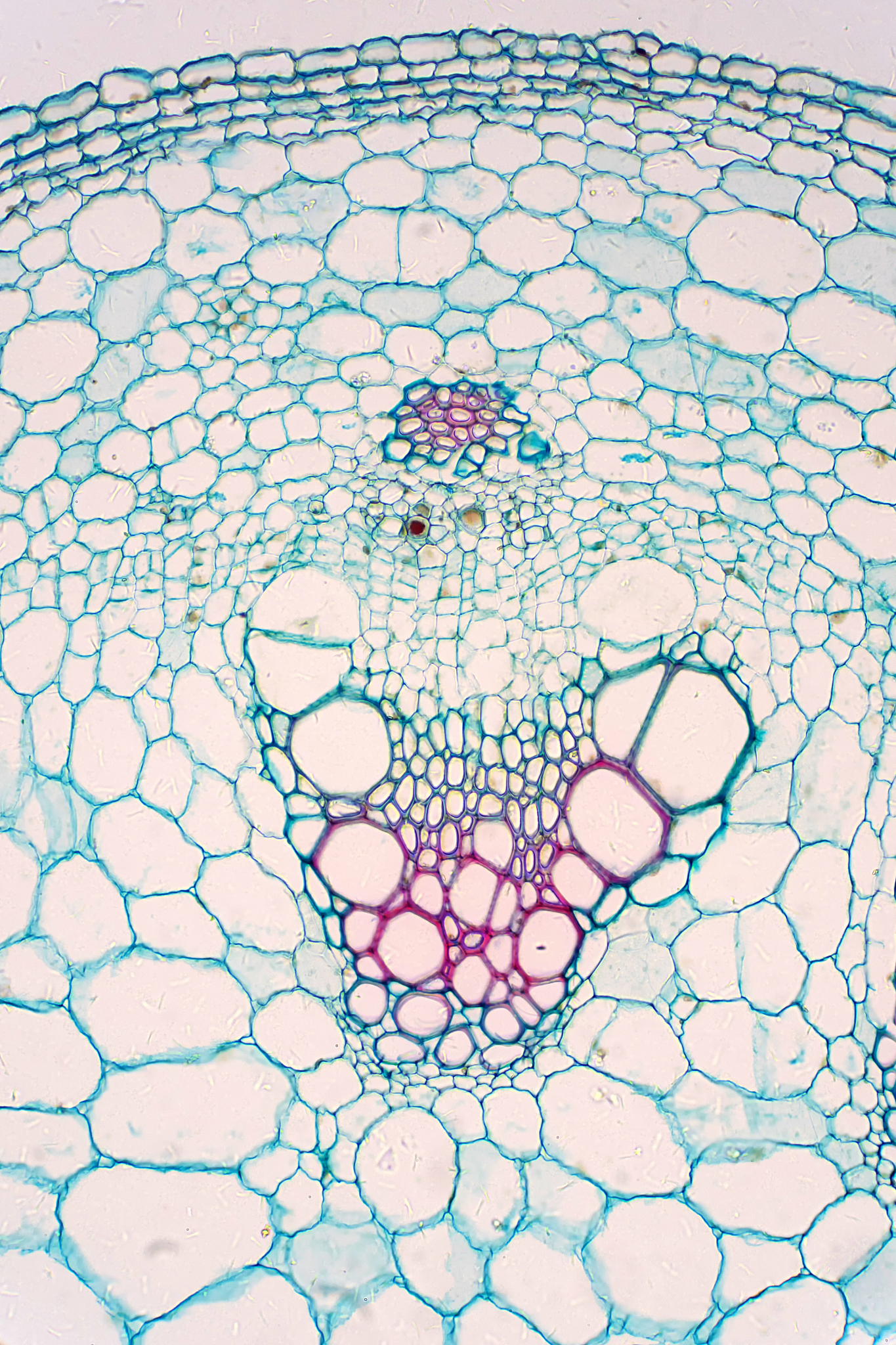顶端分生组织：植物生长的关键部位