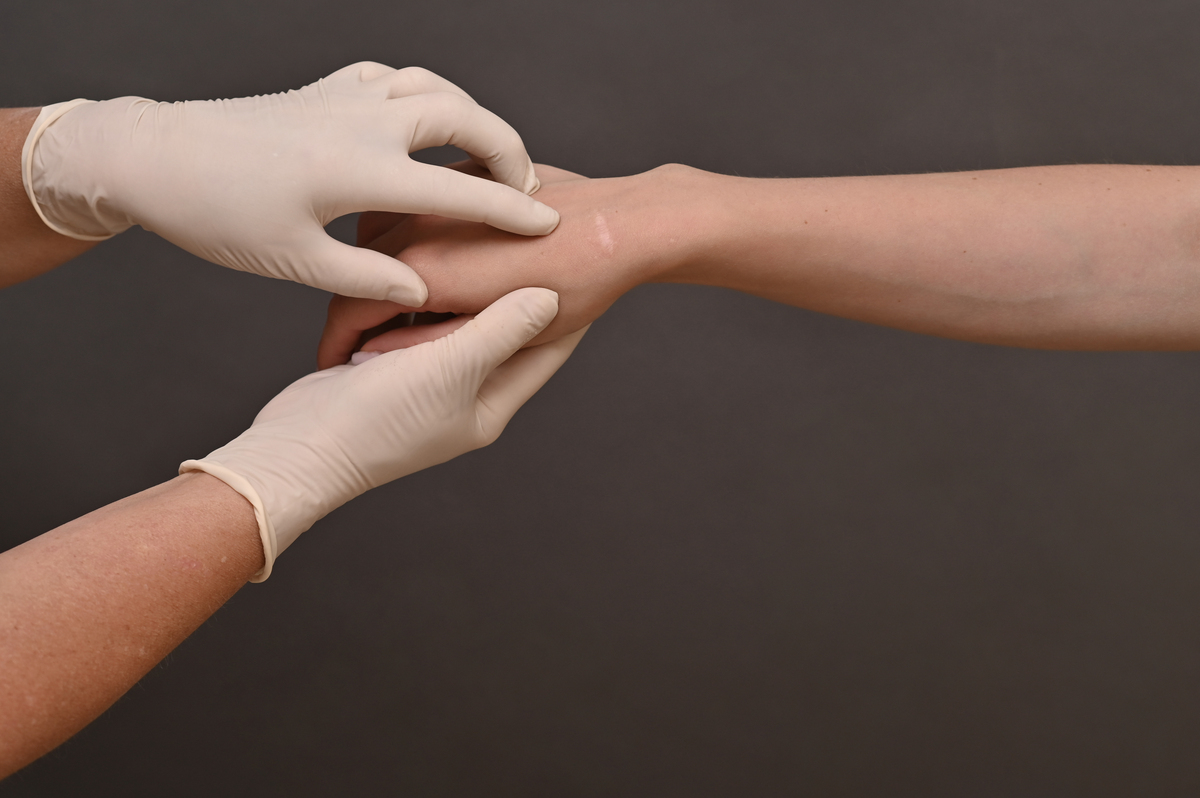 食指关节矫正方法：治疗方案及注意事项