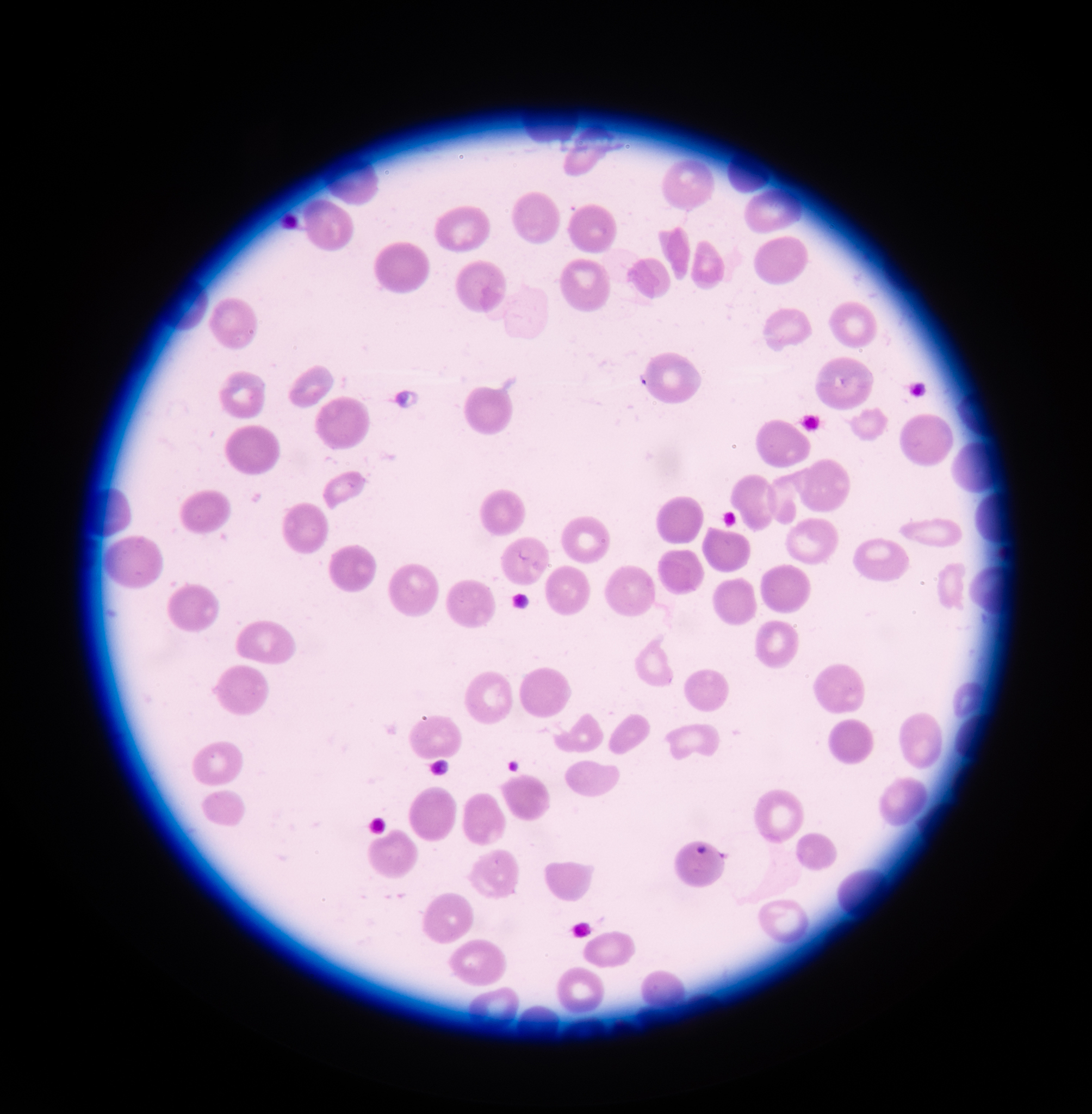 哌拉西林会引起骨髓造血停滞吗