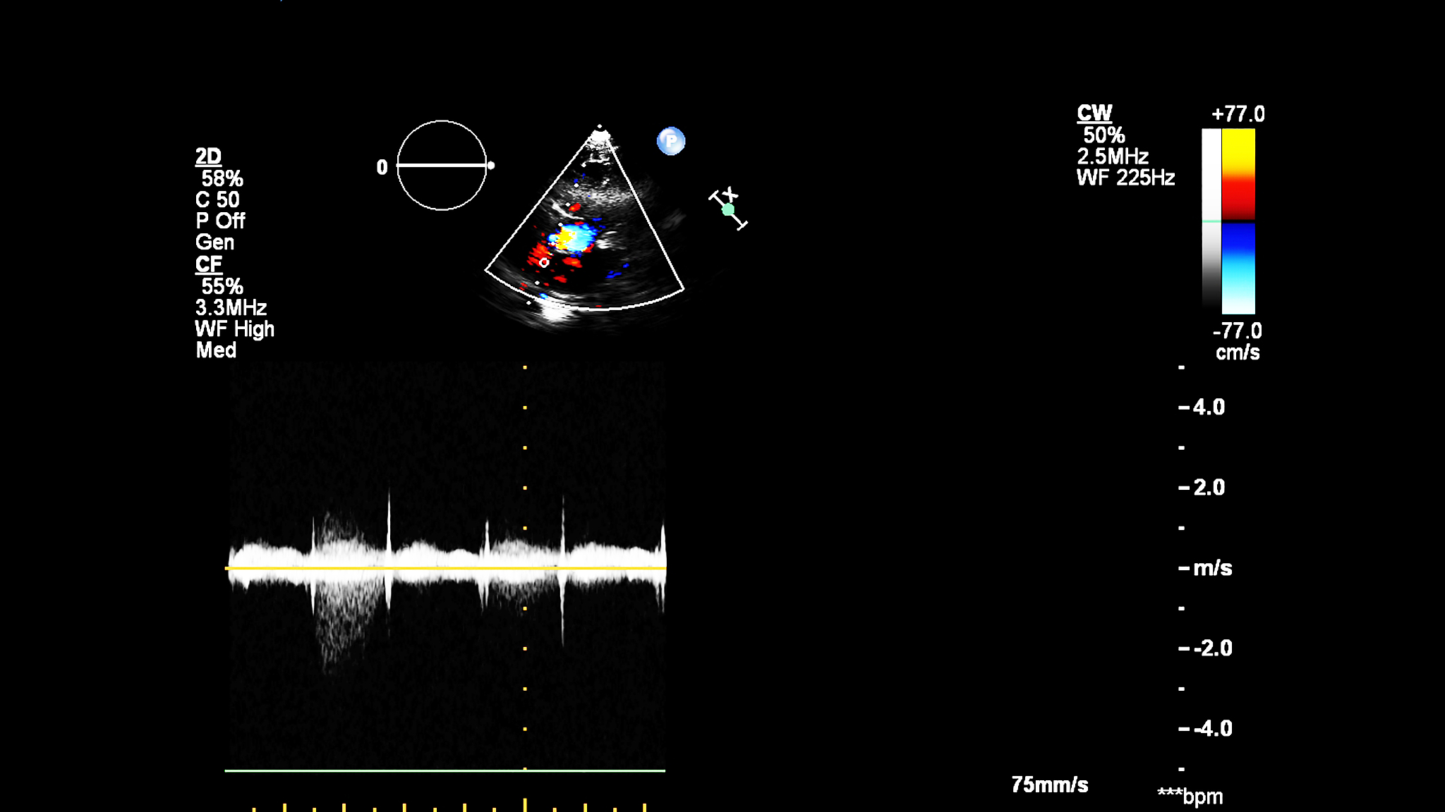 进气噪声不包括以下哪种。A进气管的气柱共振噪声B 涡流噪声C周期性压力脉动噪声D缸体辐射噪声