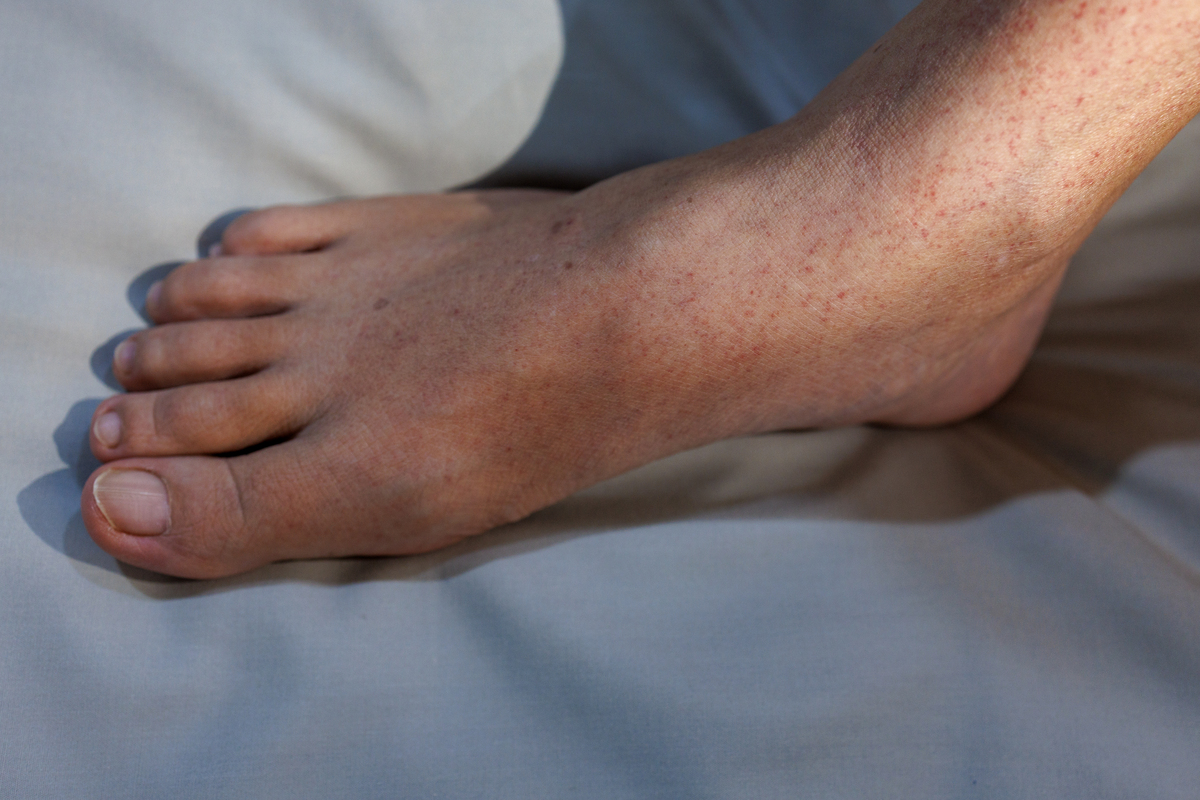 用疼痛的性质分类脚扭了的痛是什么痛