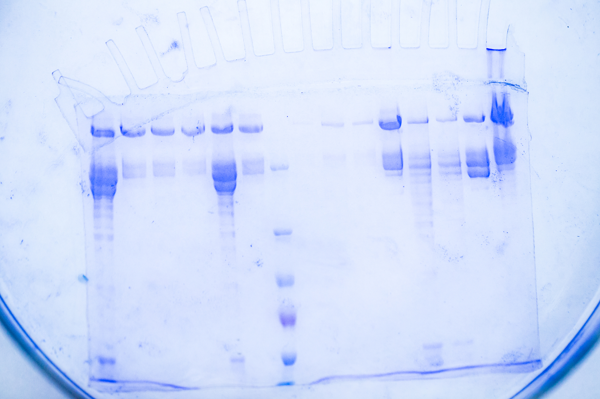 犯罪现场床单可疑斑迹生物来源鉴定检验程序