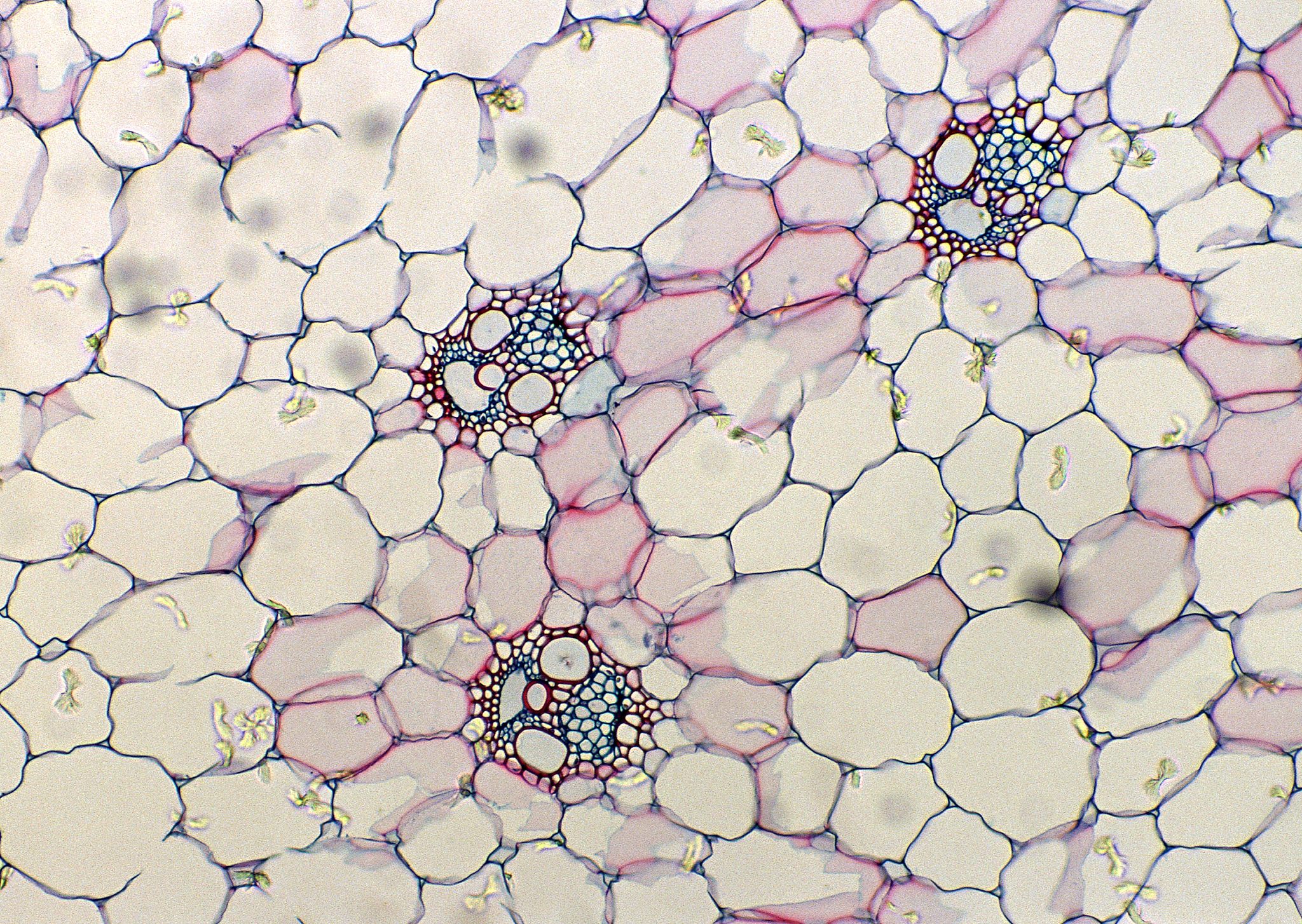 palldin蛋白影响细胞迁移可能的机制 palldin蛋白影响细胞迁移可能的机制