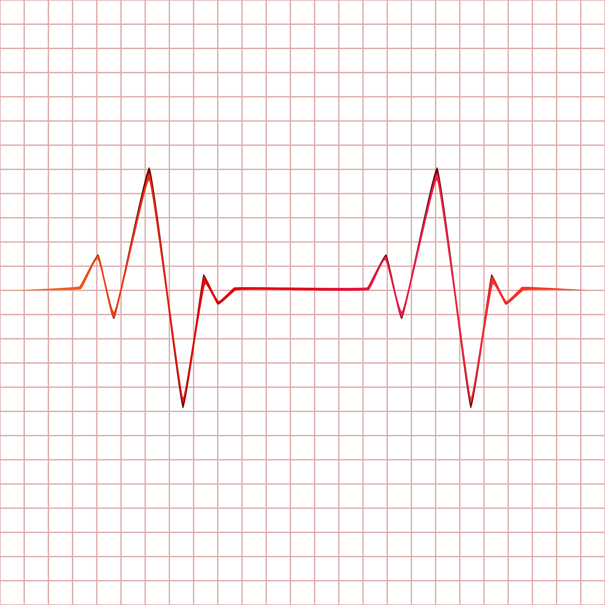 如何通过心冲击图波形分析计算心率？