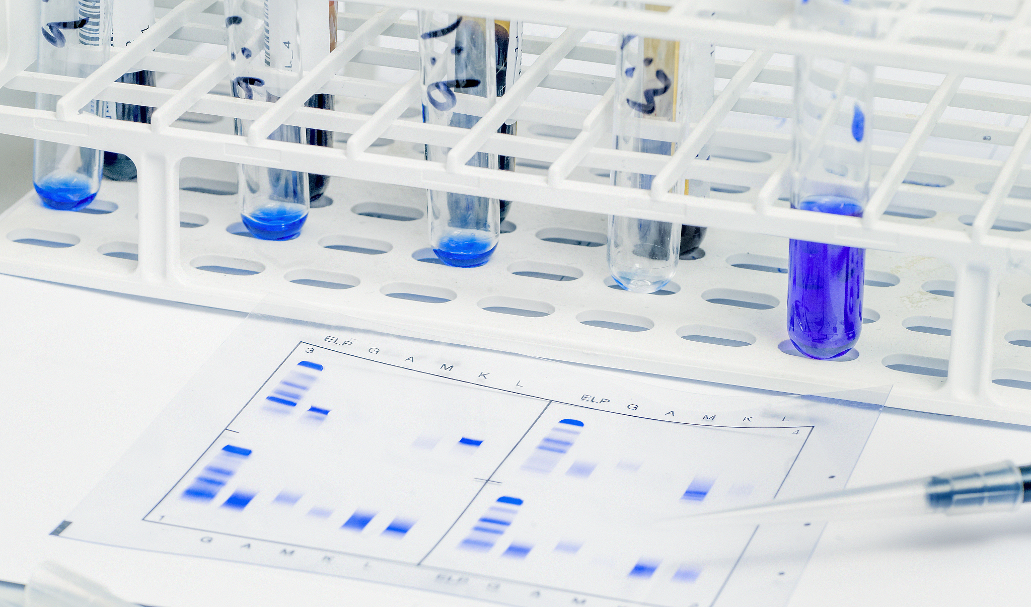 ELECTROPHORESIS期刊详细介绍