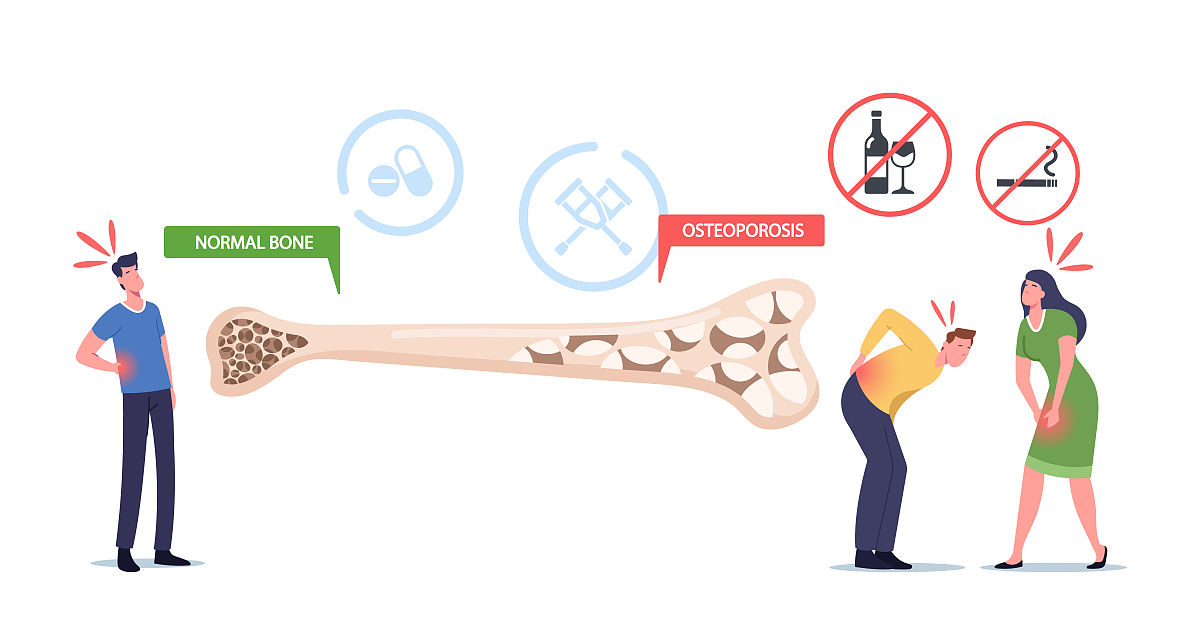 《女性与男性骨质疏松症有何不同？》请写一篇600字左右的文章，要通俗易懂有趣味