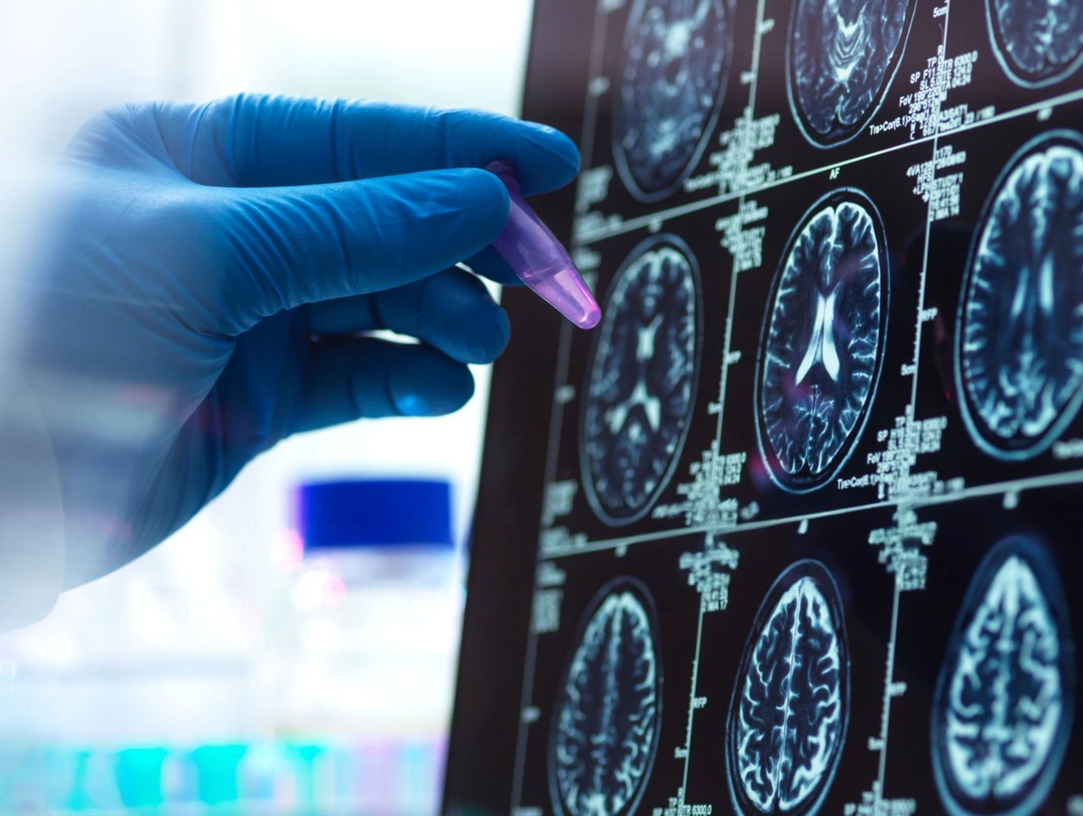 人工智能新方法：基于多维度中医影像信息（舌诊、面诊、脑CT）的疾病诊断和疗效评价