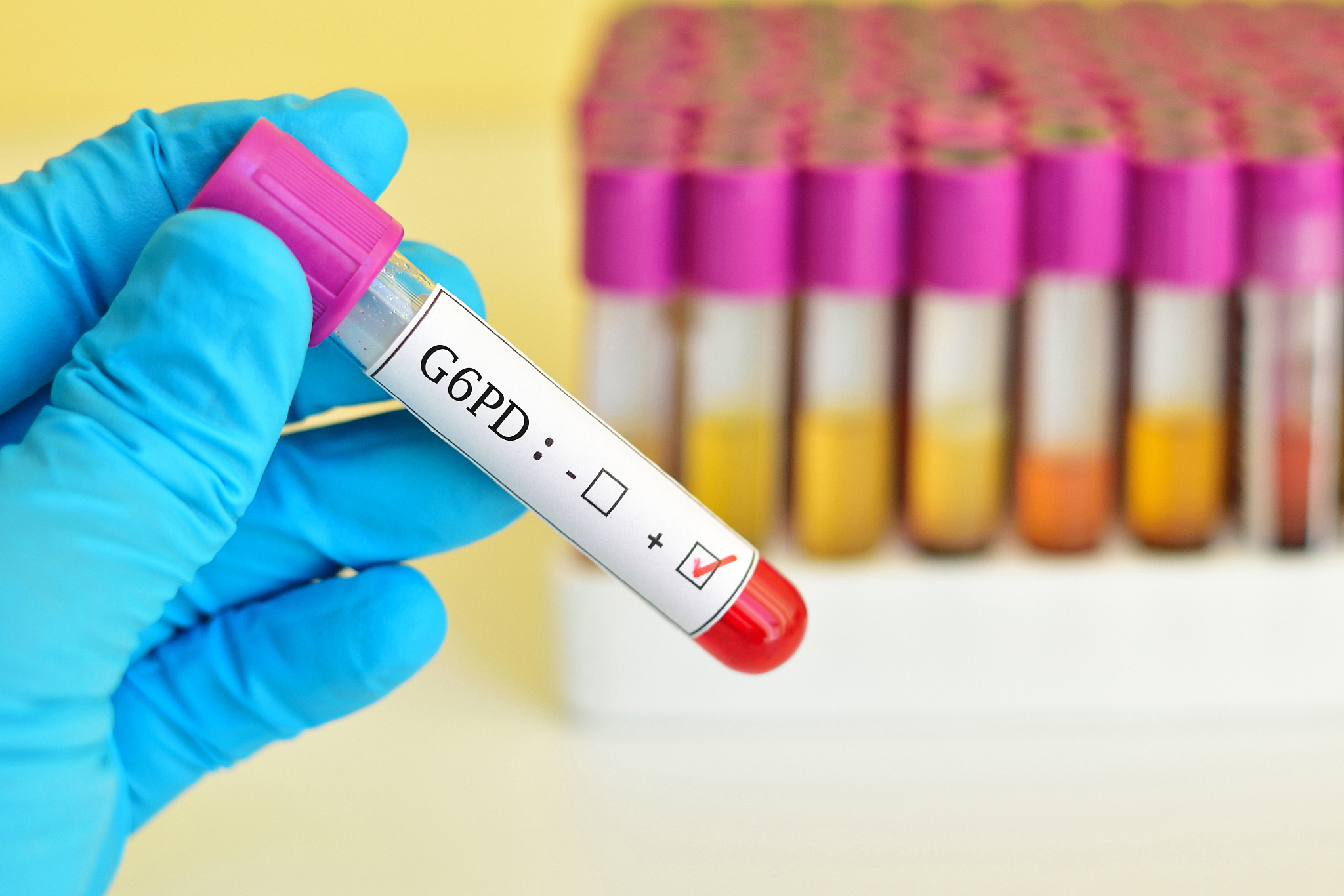 葡萄糖生成的关键酶