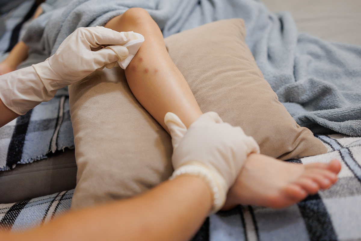 身上痒挠一个地方没用，挠另一个地方却能缓解？