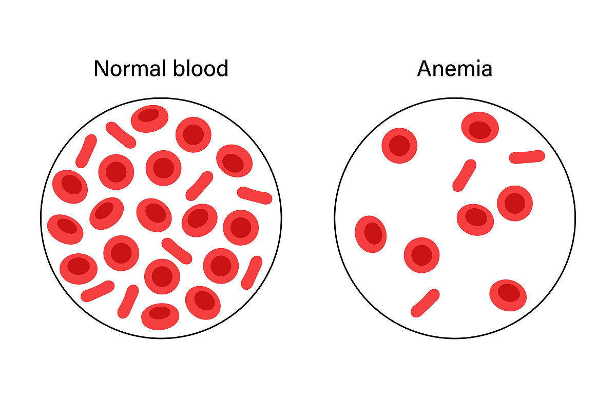 离体血液不加抗凝剂会发生什么？
