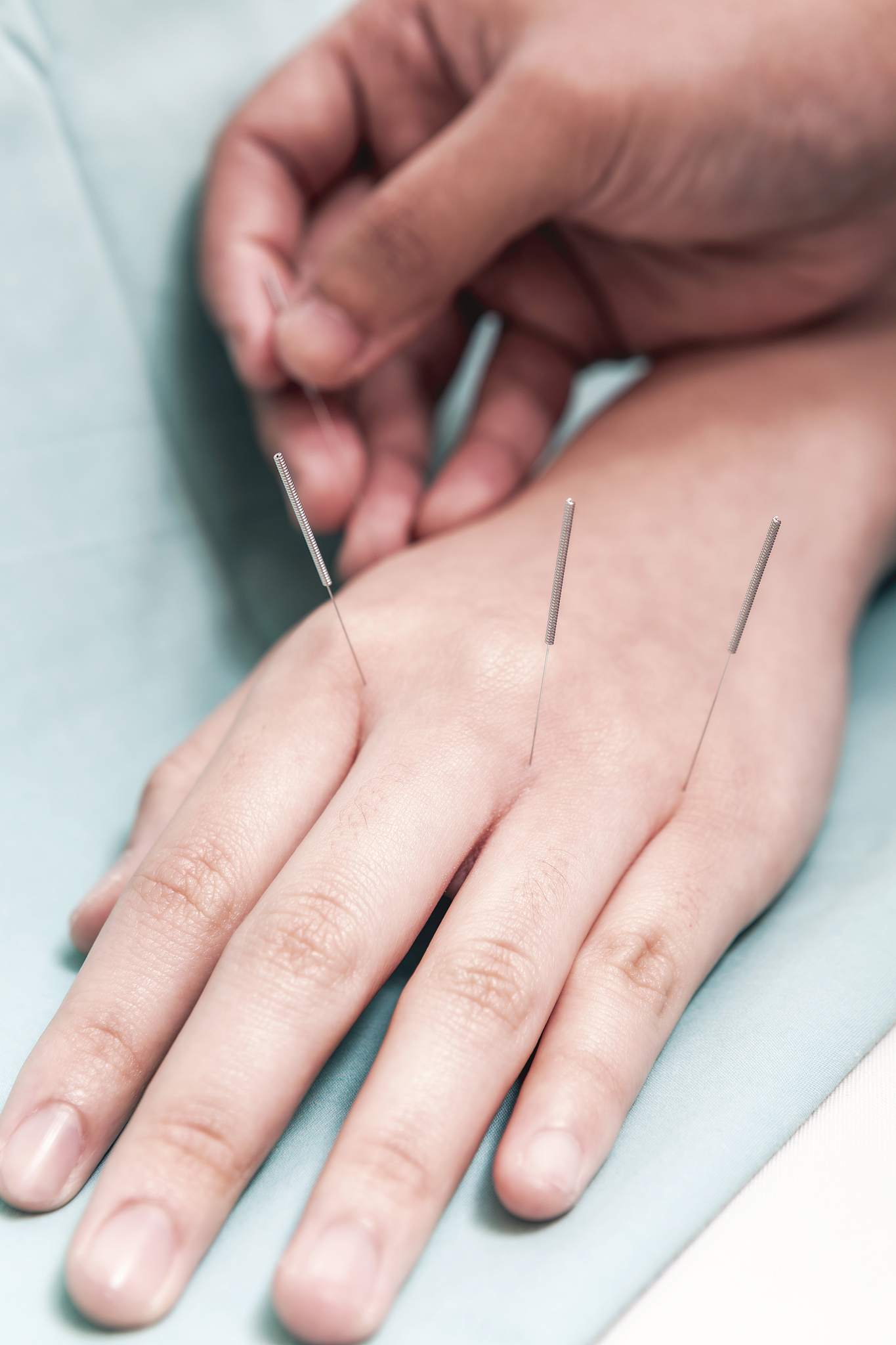 cropped image of person doing acupuncture