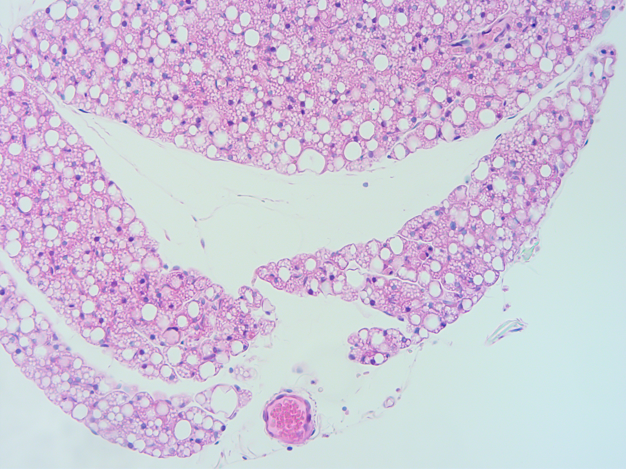 Cresyl Violet Staining Procedure for Tissue Slices