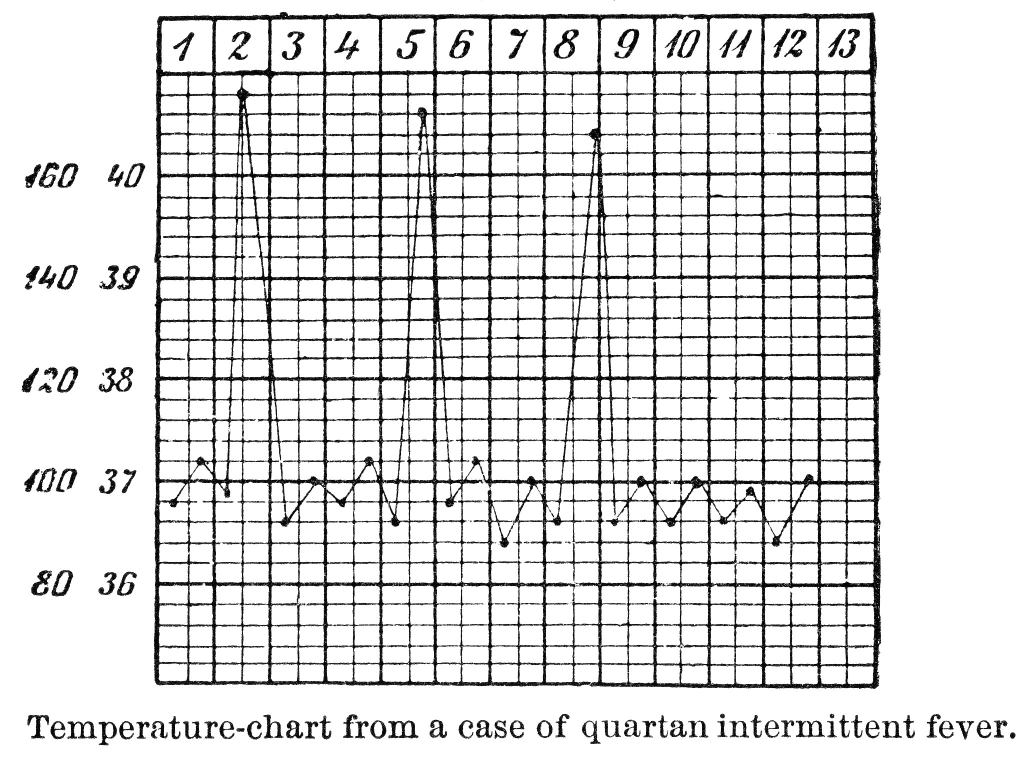配对样本t检验：例题与步骤详解