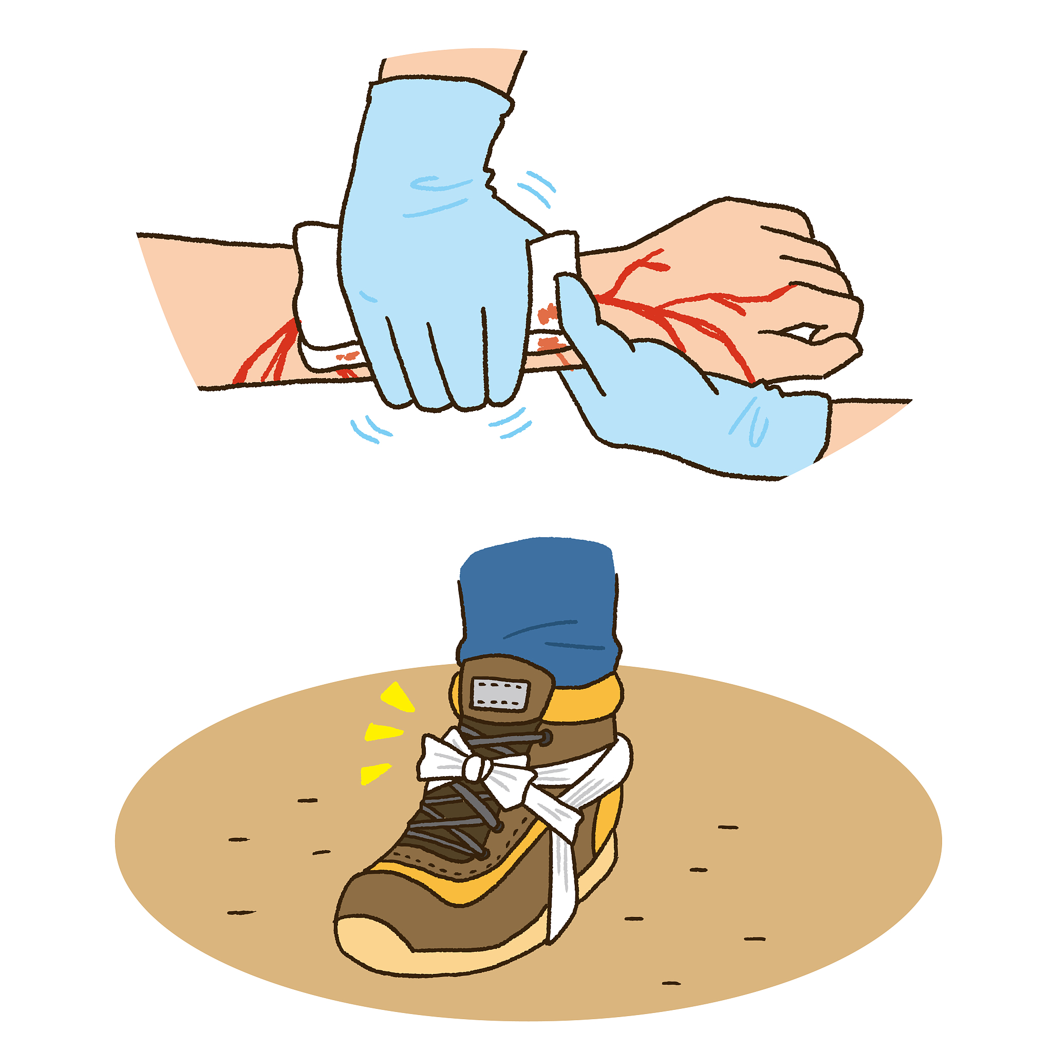 骨折受伤急救：止痛方法和注意事项