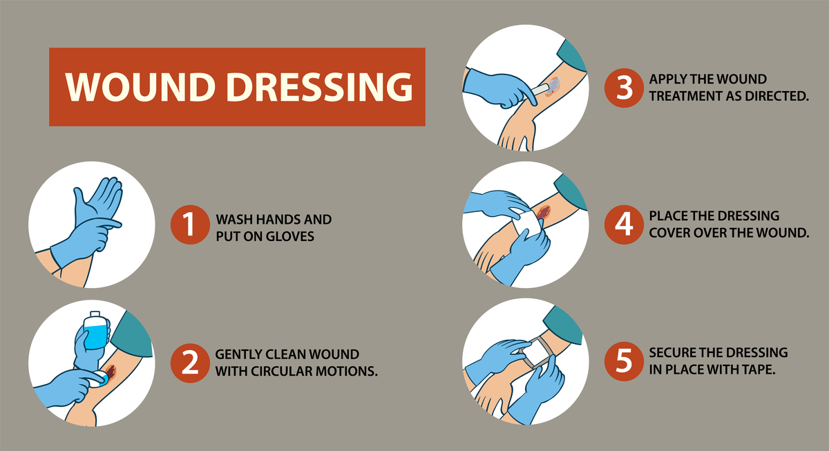 戴手套真的能保证手部卫生吗？你需要知道的真相！