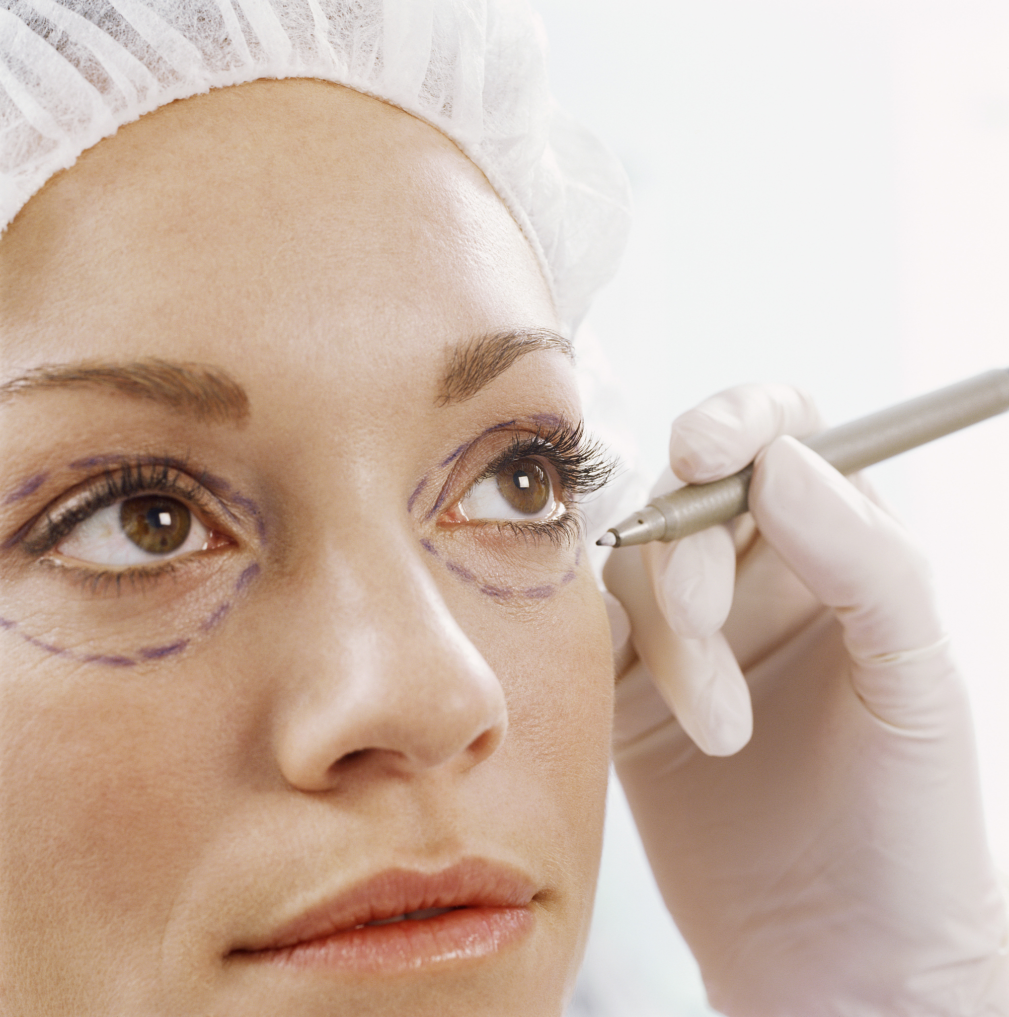 眼袋大最简单的去眼袋的方法