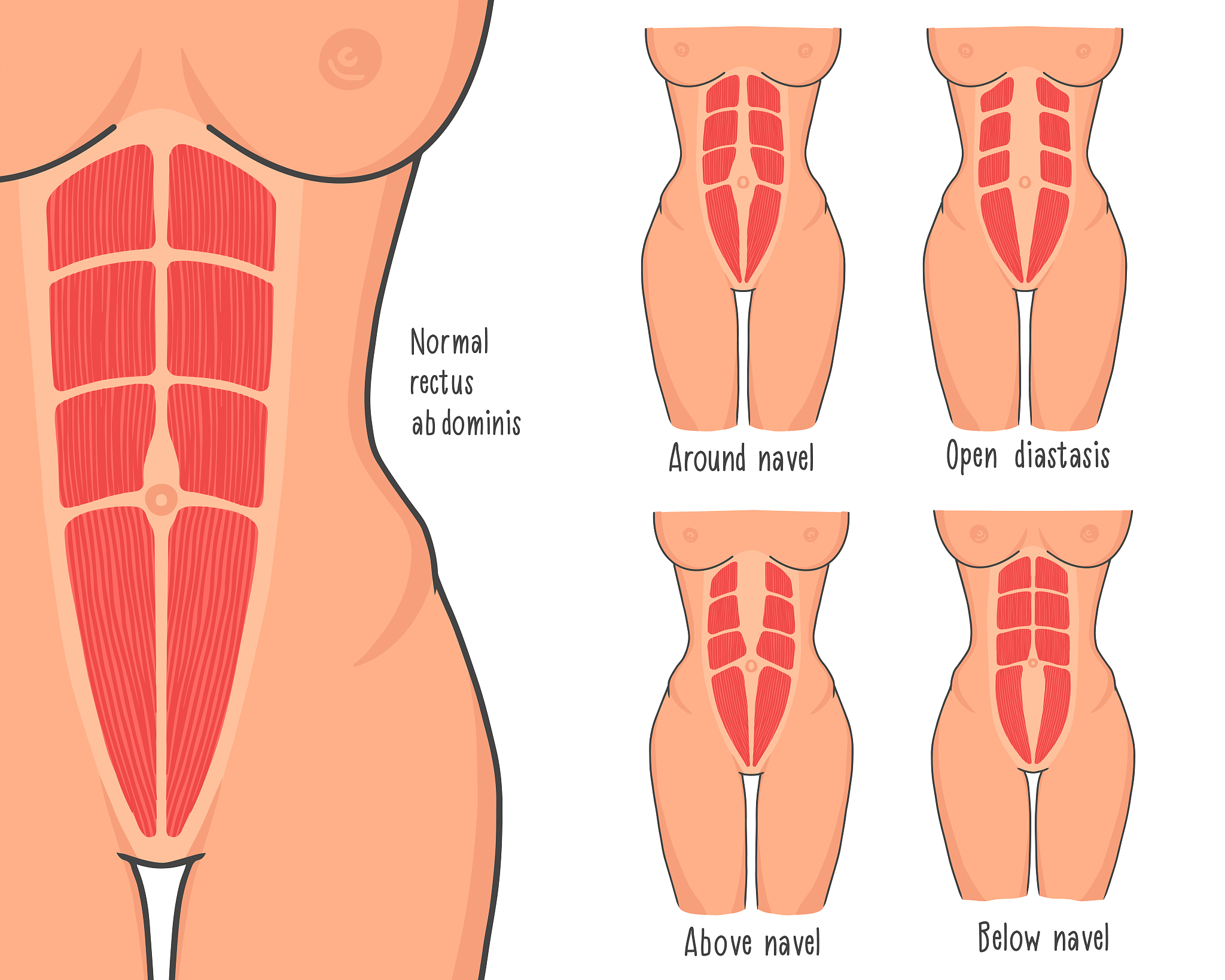 腹部疾病诊断与治疗：常见问题及答案