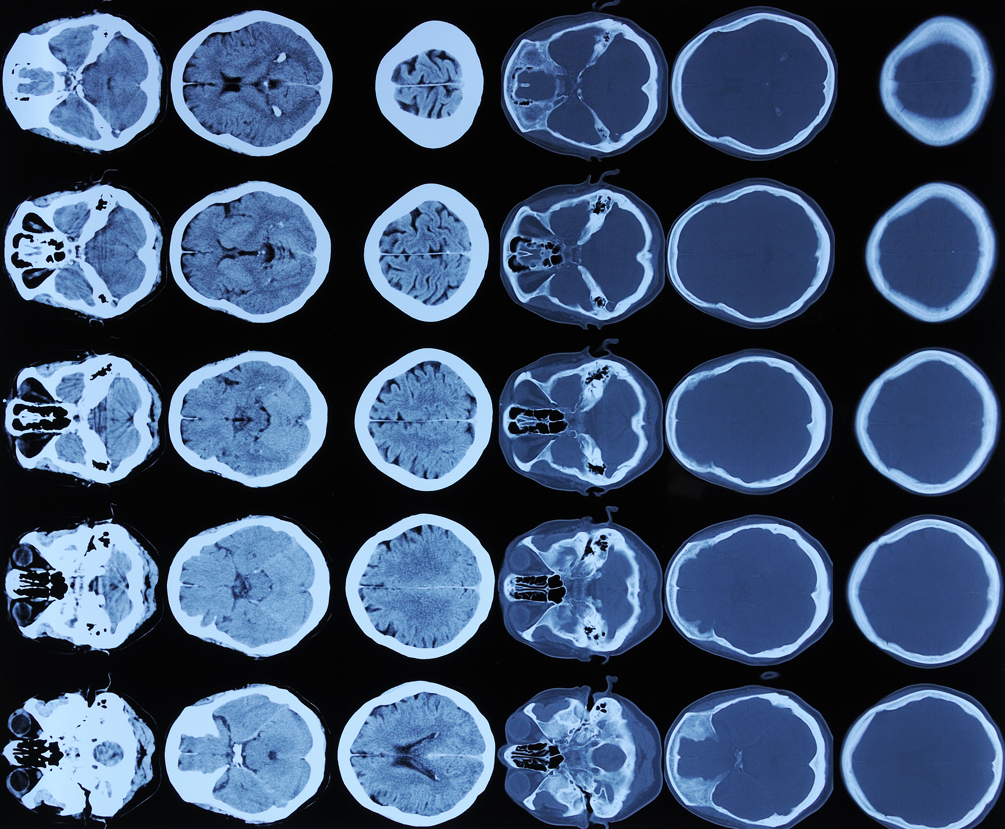 International MICCAI Brainlesion Workshop中文介绍它是几类会议？