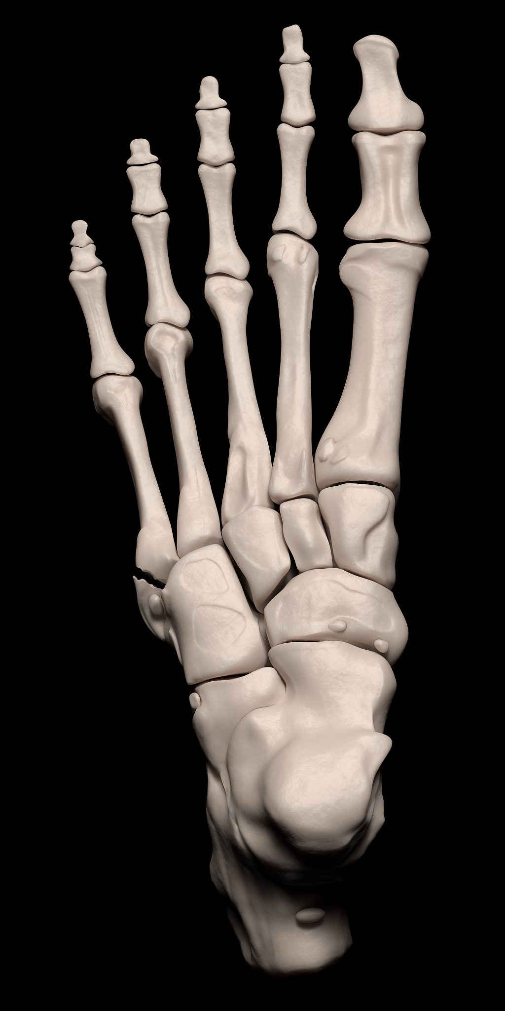 pseudo-jones fracture or dancer's fracture of the fifth metatars