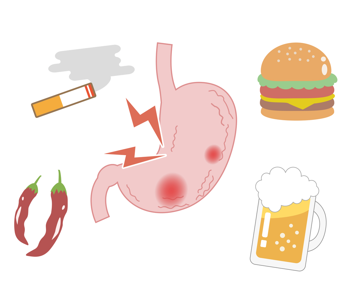 3种错误喝水习惯，正在悄悄损伤你的肾脏