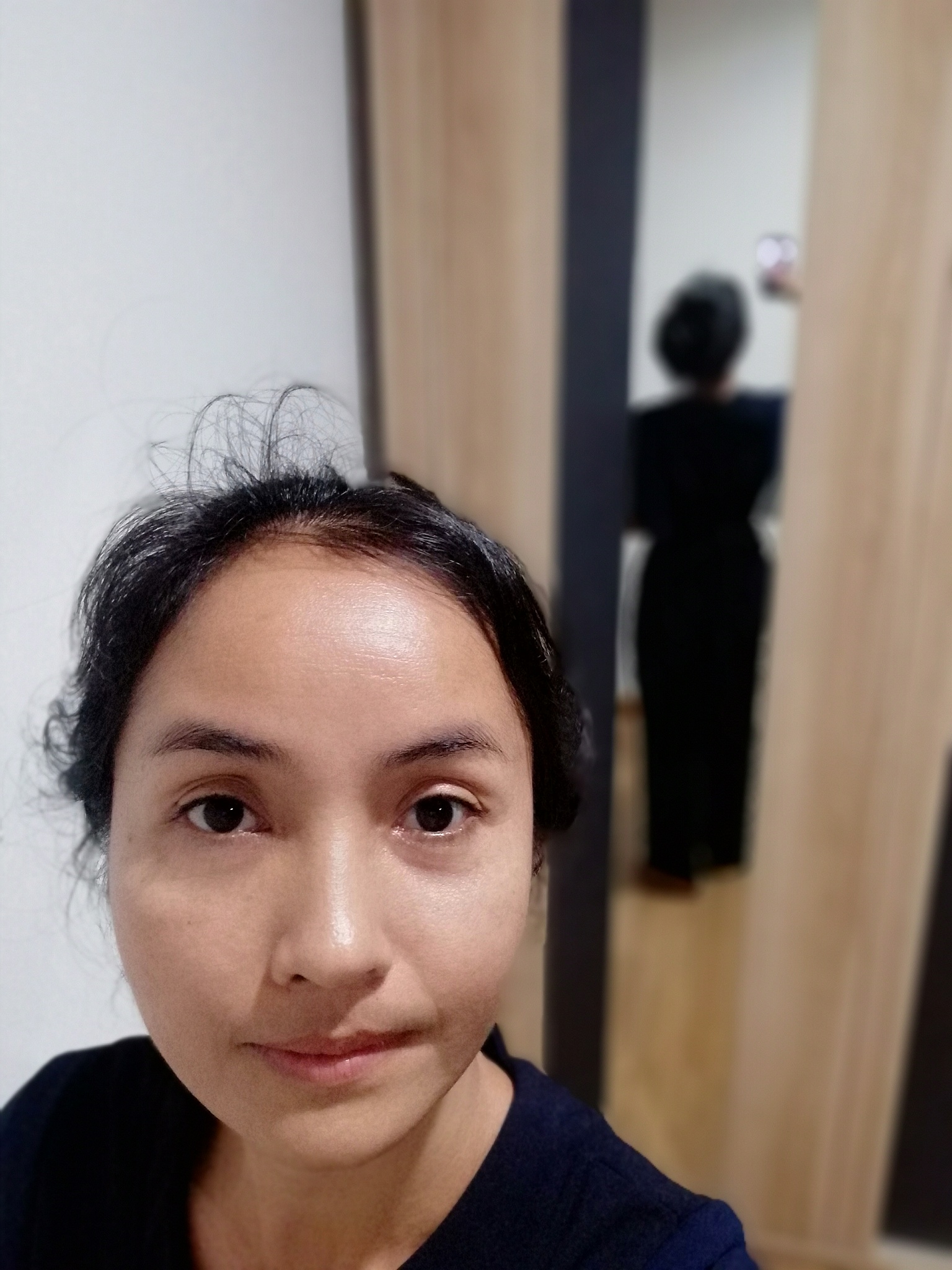 双下巴下颌缘吸脂+假体下巴朋友圈爆款文案不少于40字