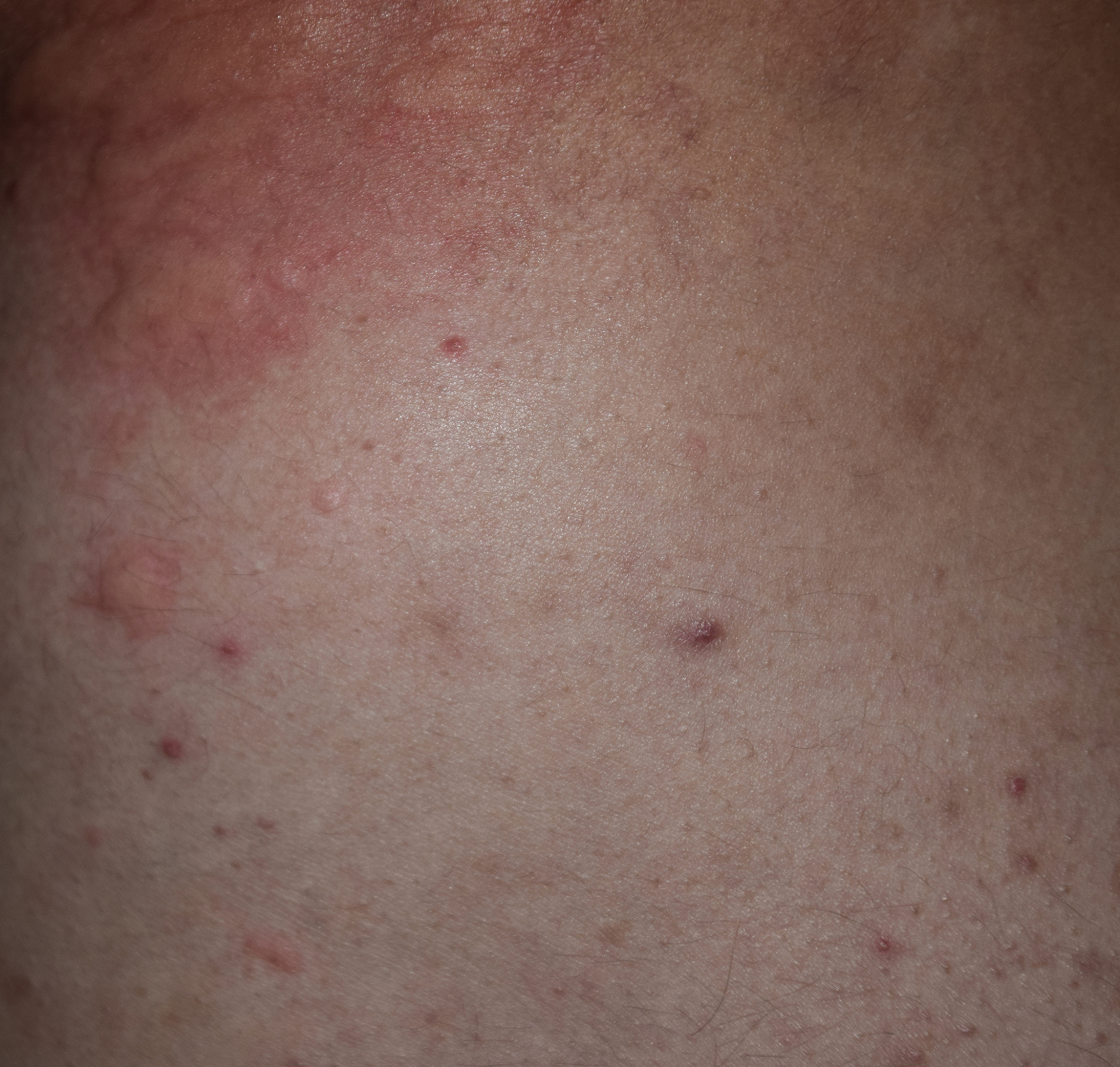 allergy skin back and sides