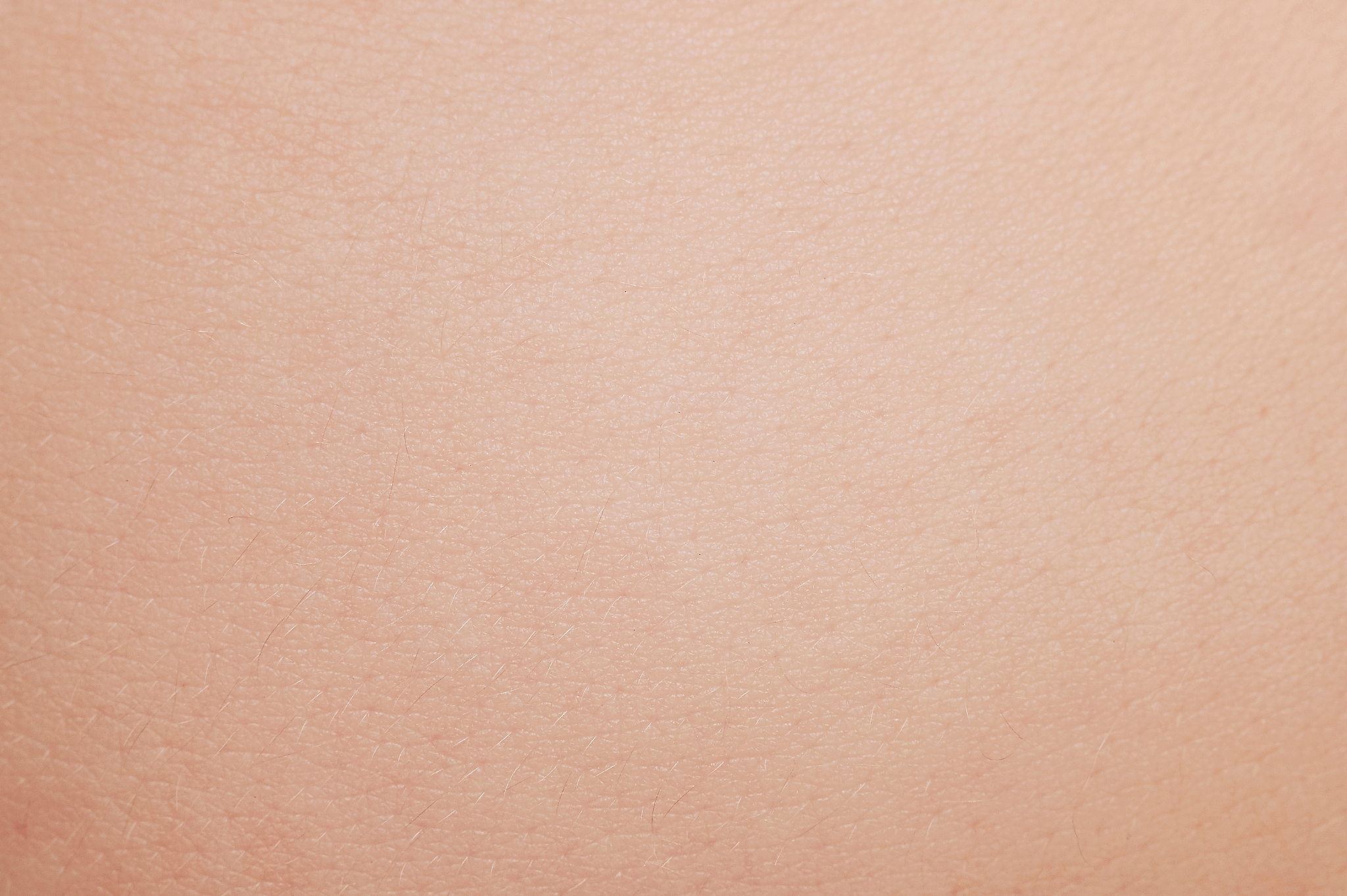 婴儿腿纹不一致怎么办