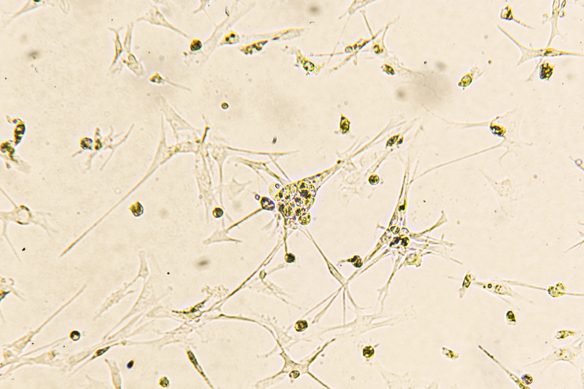 F81细胞培养、病毒接种及传代方法