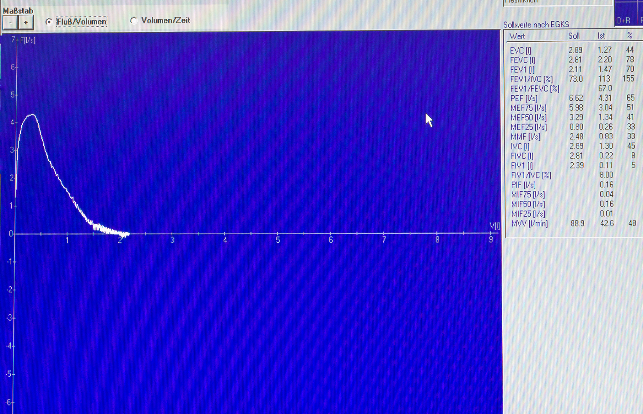 CPoint该如何定义？