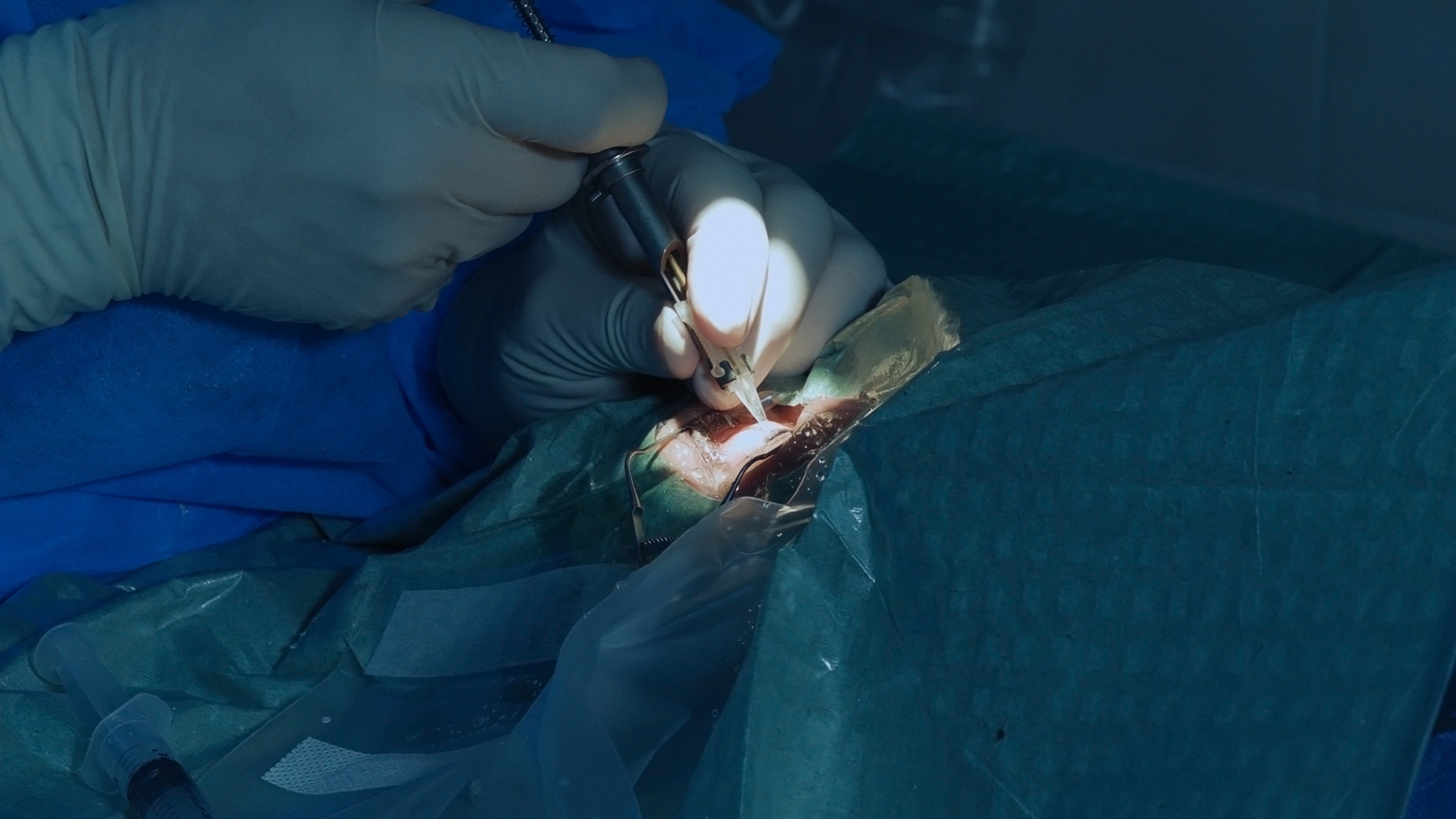 eye microsurgery. medical operation
