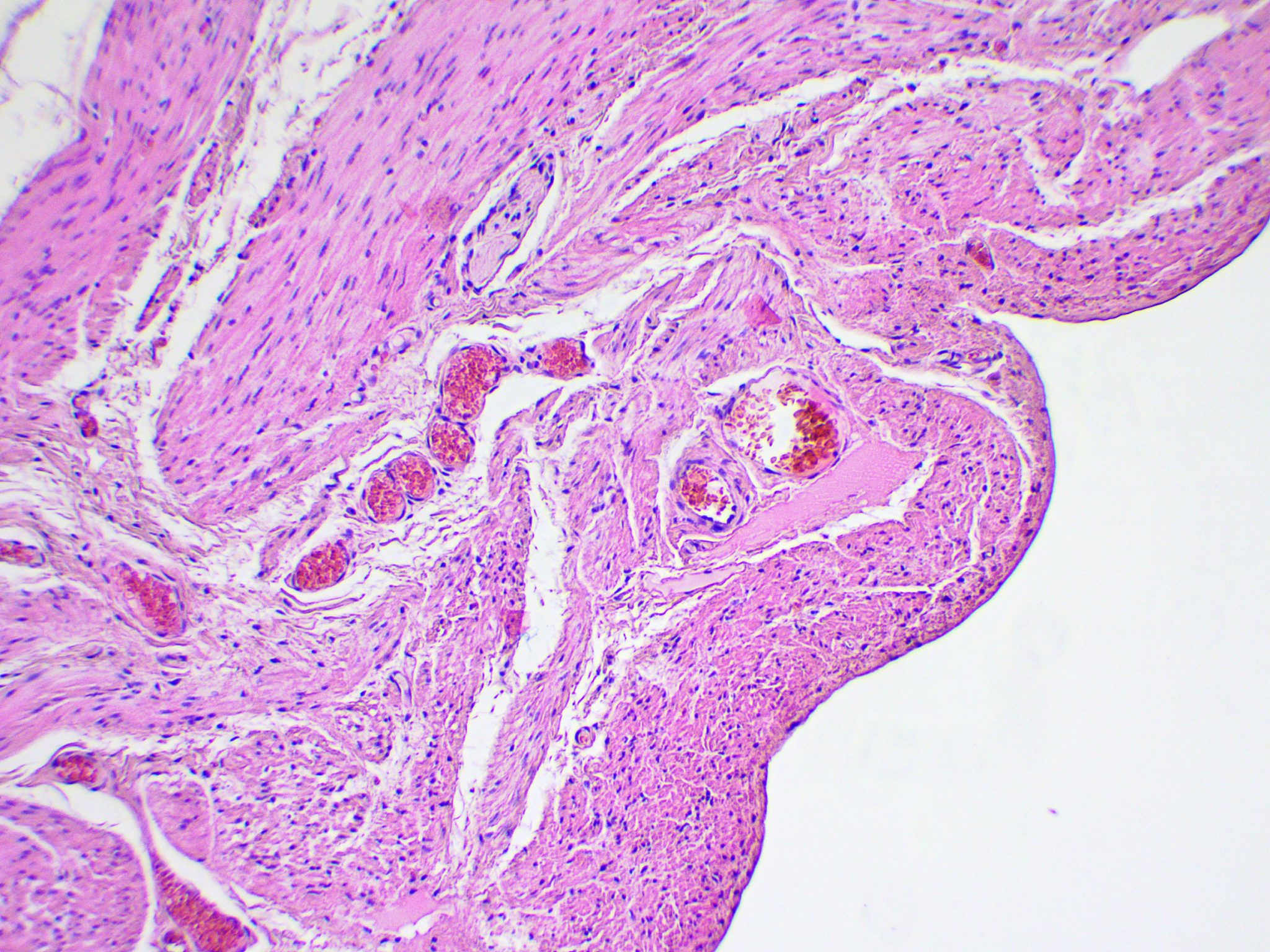 空肠粘膜中SNAT2、CAT1和B0AT1 mRNA表达的限制性饮食模式影响
