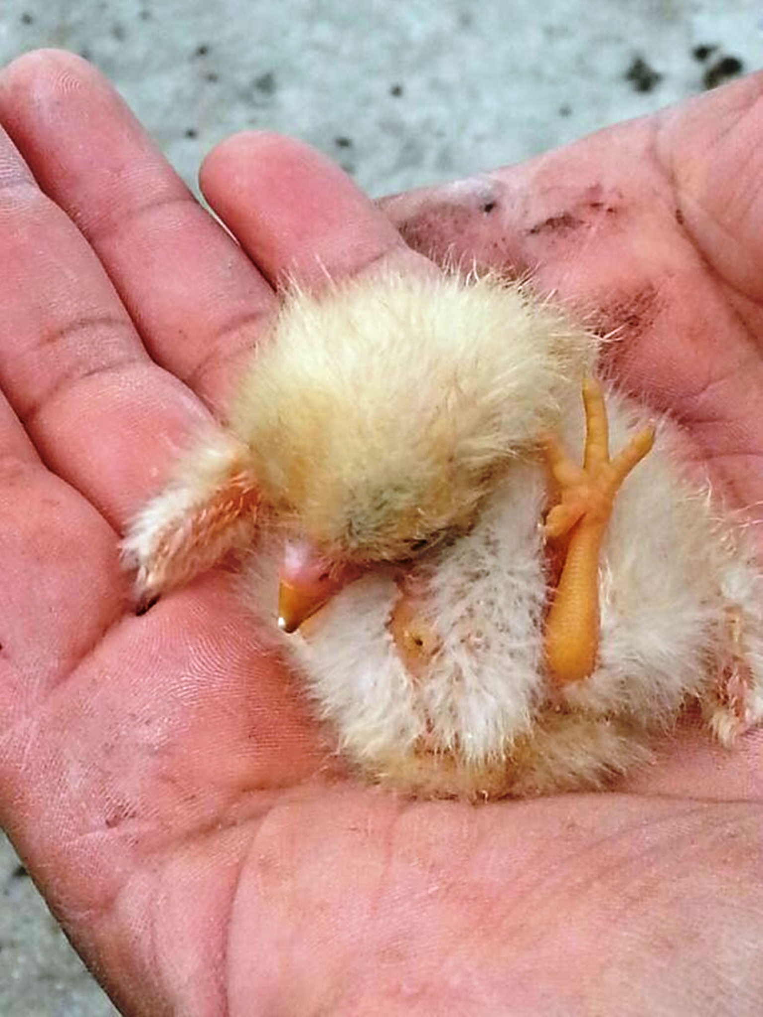 鸡茧：足底角化病的症状和治疗