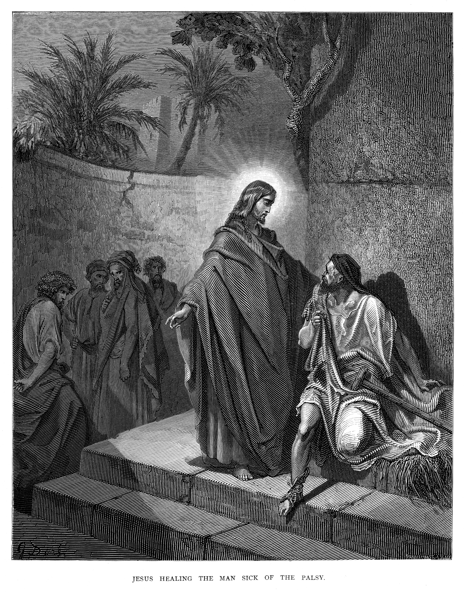 微创手术治疗慢性踝关节不稳: 一项回顾性分析