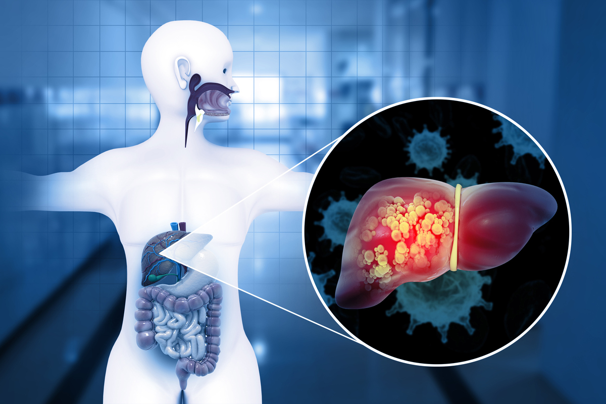 肝癌病人免疫状况如何
