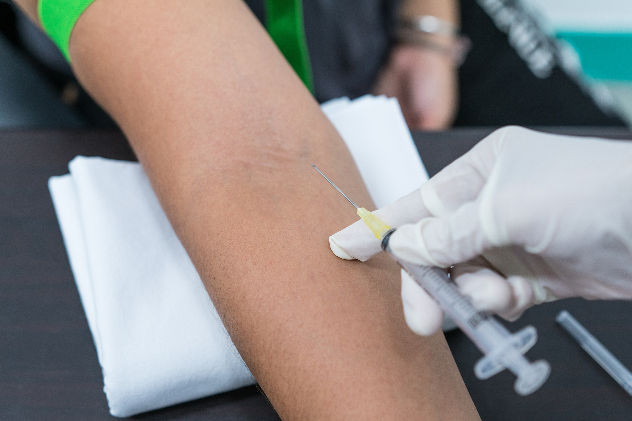 舒霖笔注射部位：腿部静脉治疗静脉曲张