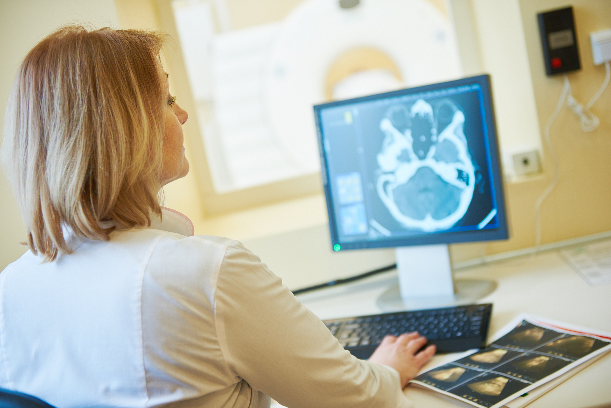 工业ct 根据扫描参数计算分辨率